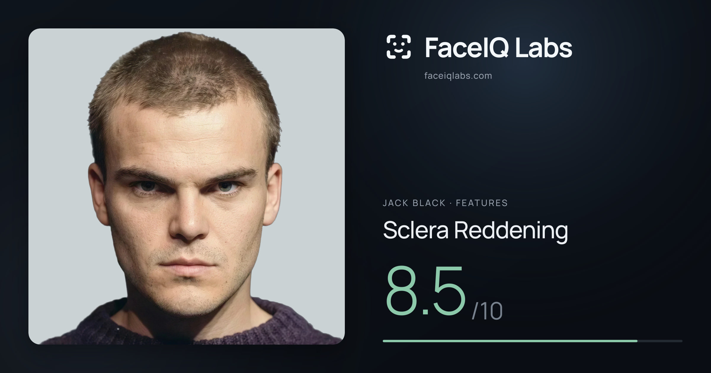 Jack Black Sclera Reddening: 8.5/10, drawn on the photo