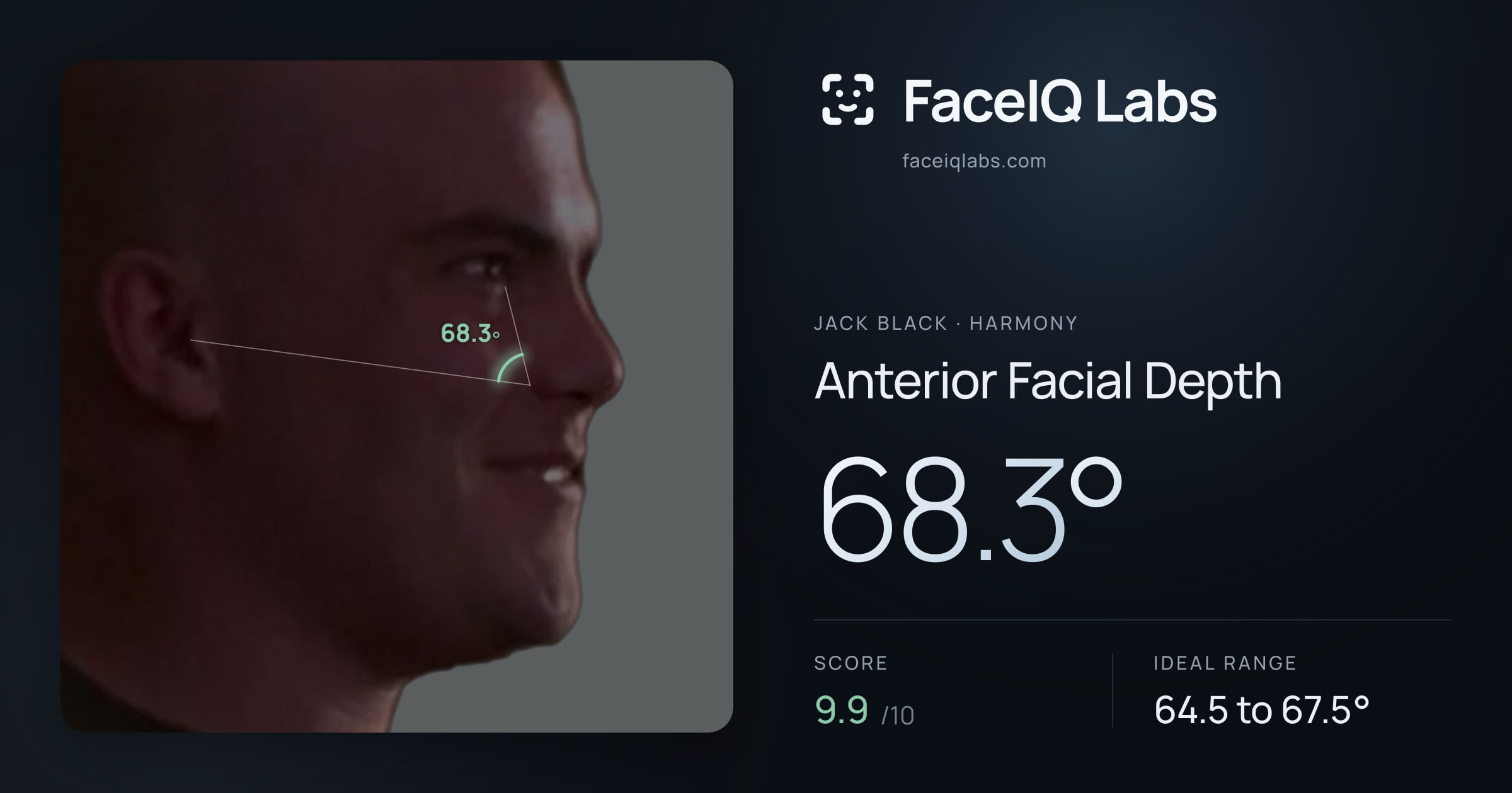 Jack Black Anterior Facial Depth: 68.3°, drawn on the photo