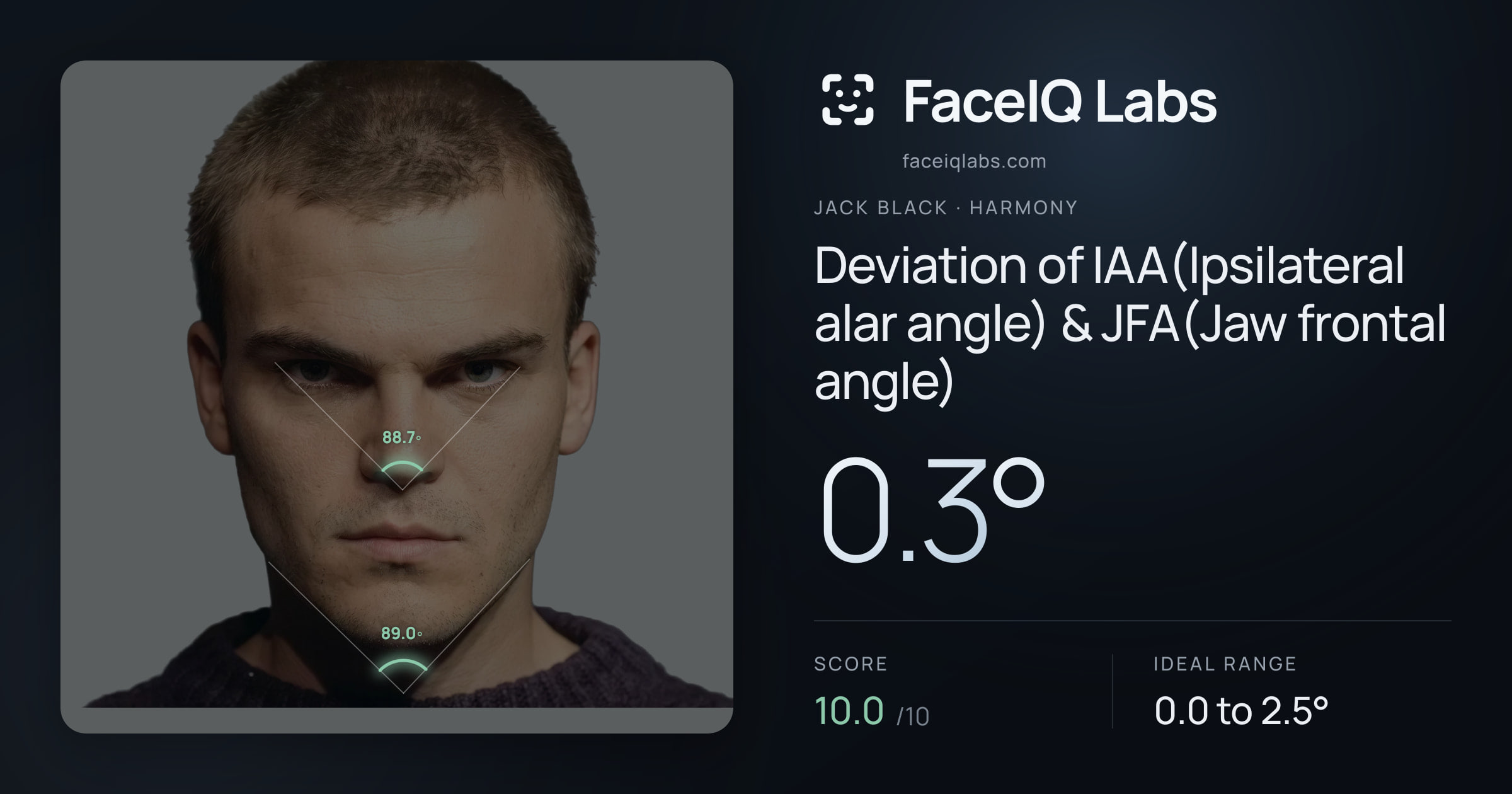 Jack Black Deviation of IAA(Ipsilateral alar angle) & JFA(Jaw frontal angle): 0.3°, drawn on the photo