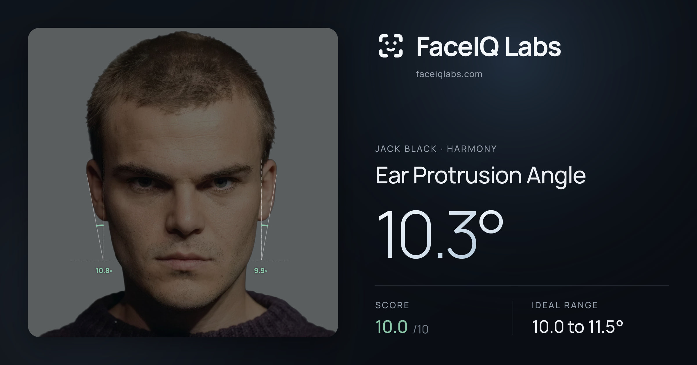 Jack Black Ear Protrusion Angle: 10.3°, drawn on the photo