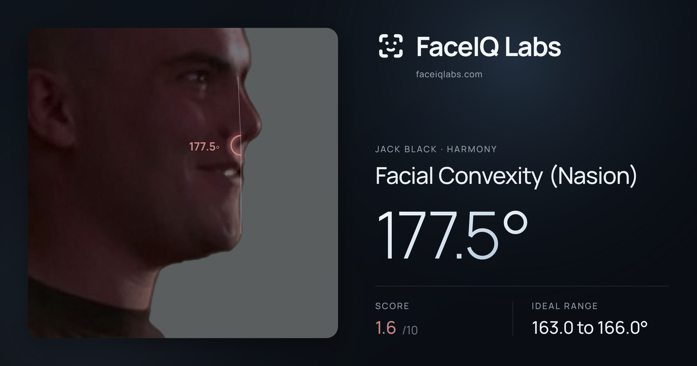 Jack Black Facial Convexity (Nasion): 177.5°, drawn on the photo
