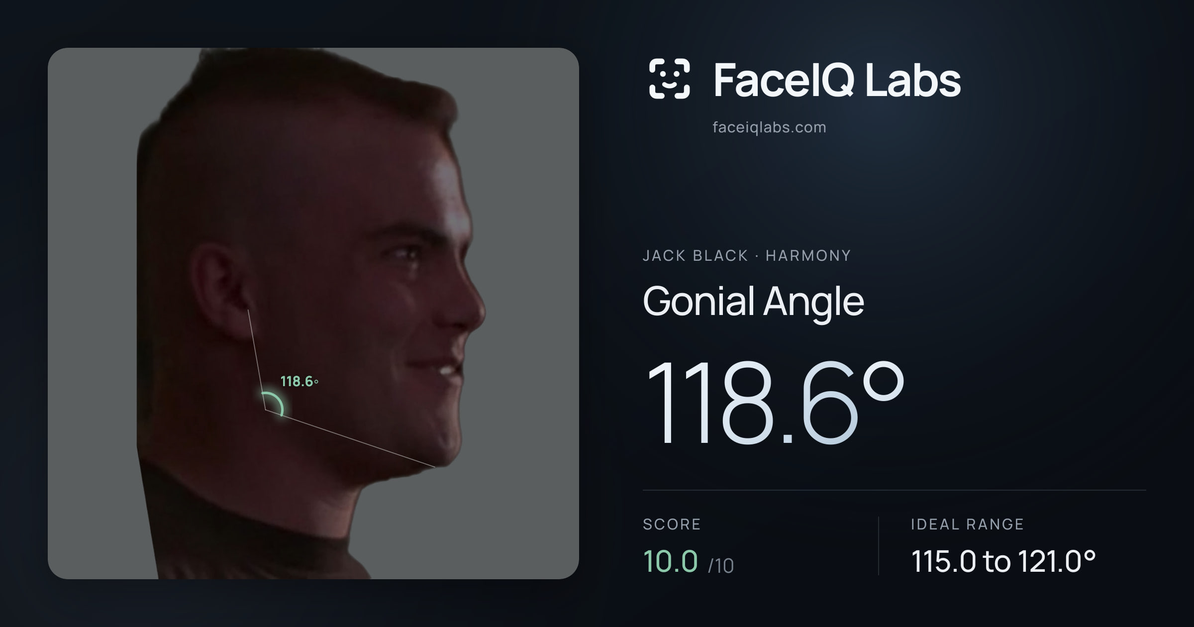 Jack Black Gonial Angle: 118.6°, drawn on the photo