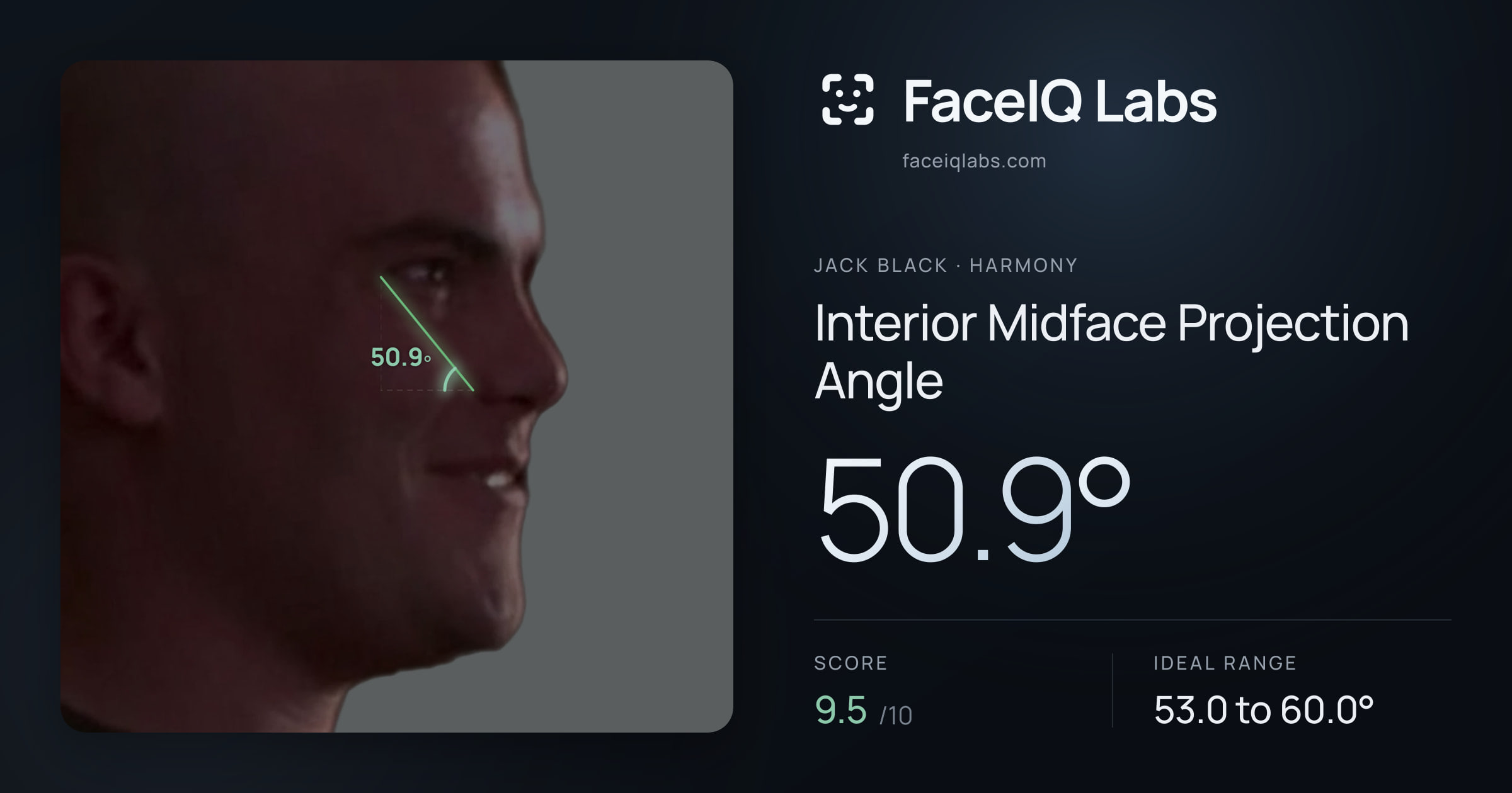 Jack Black Interior Midface Projection Angle: 50.9°, drawn on the photo
