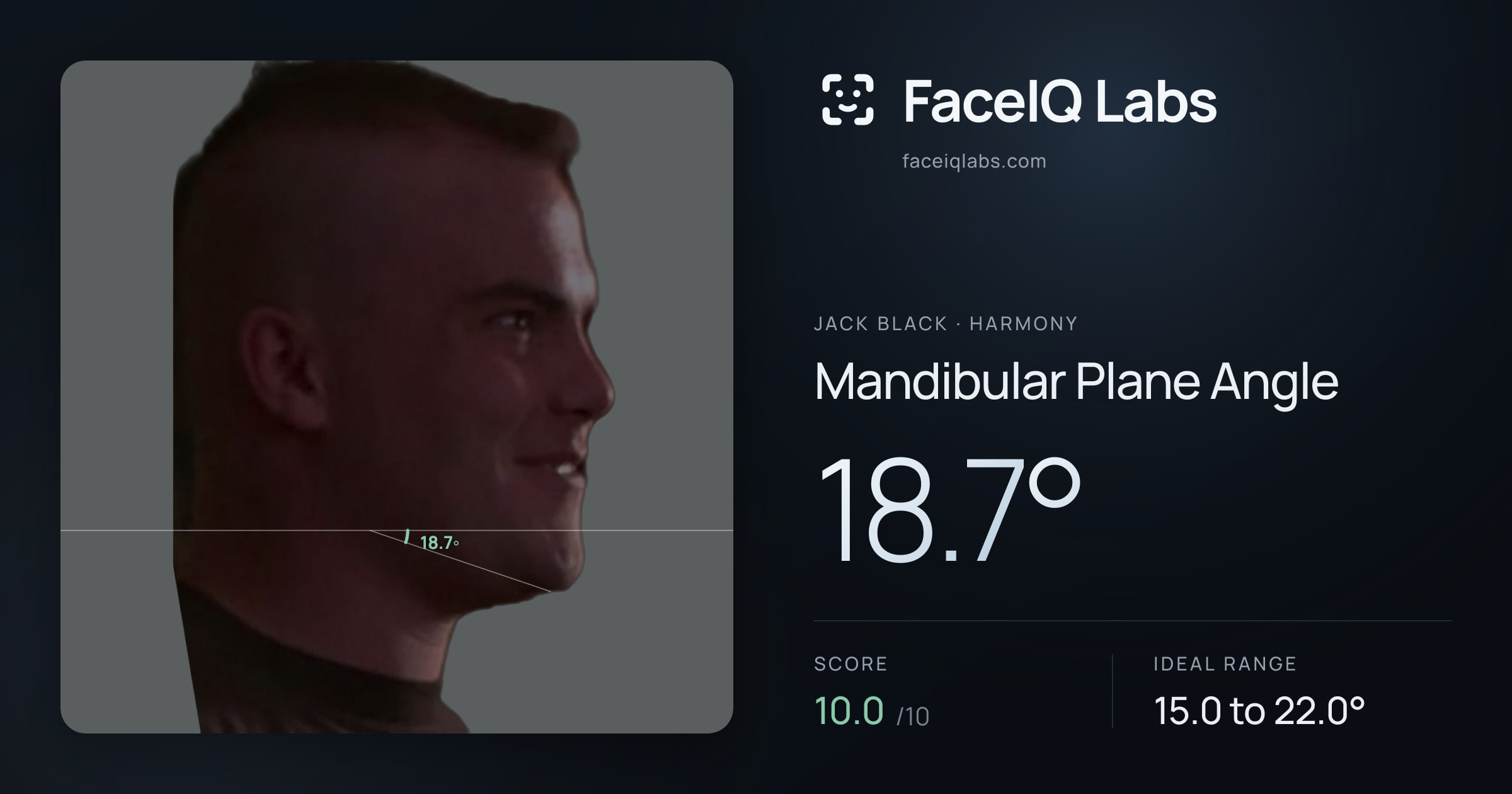 Jack Black Mandibular Plane Angle: 18.7°, drawn on the photo