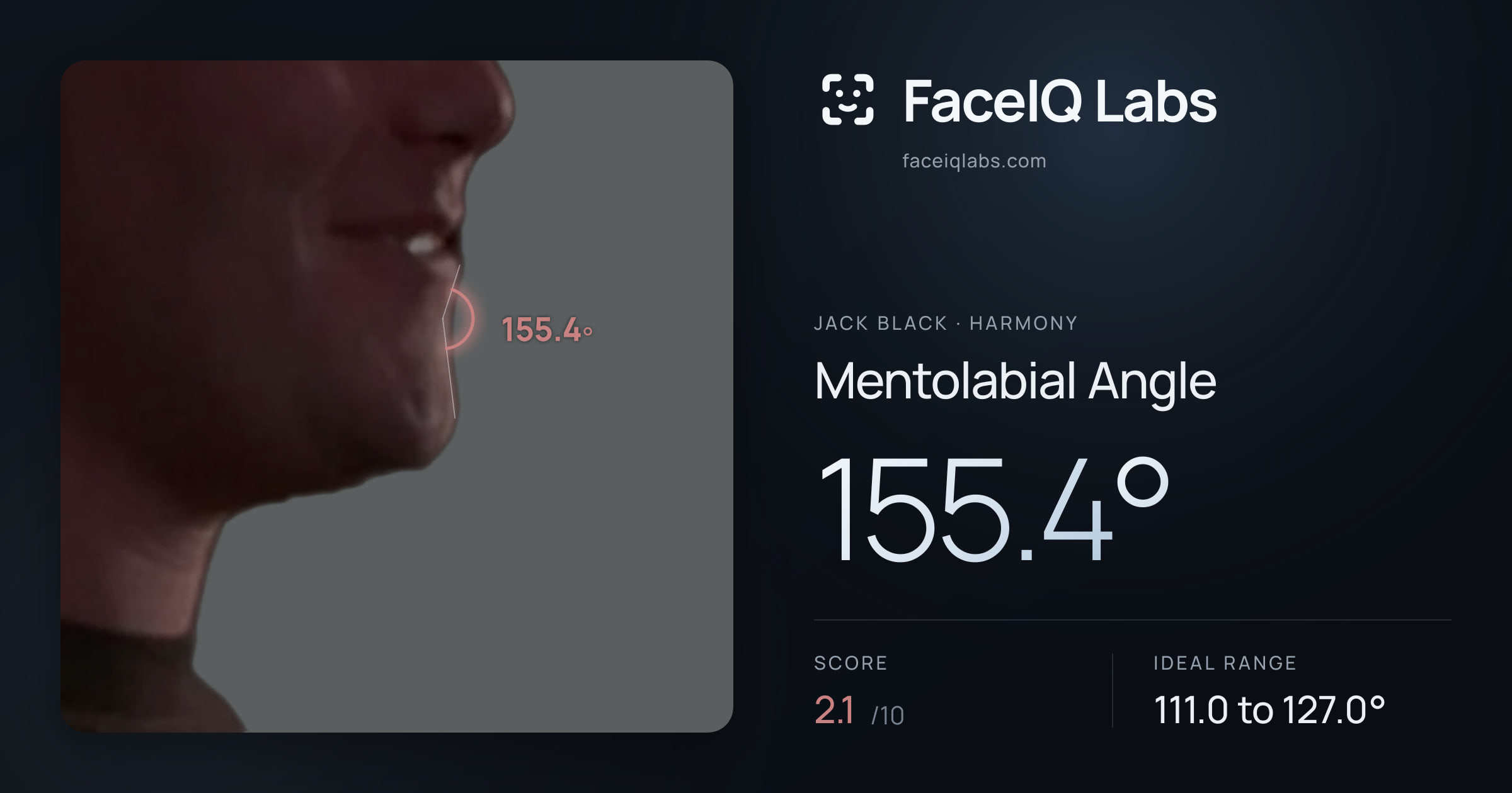 Jack Black Mentolabial Angle: 155.4°, drawn on the photo