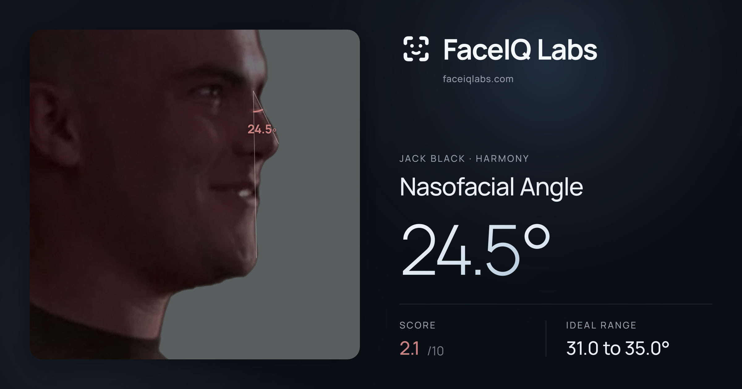 Jack Black Nasofacial Angle: 24.5°, drawn on the photo