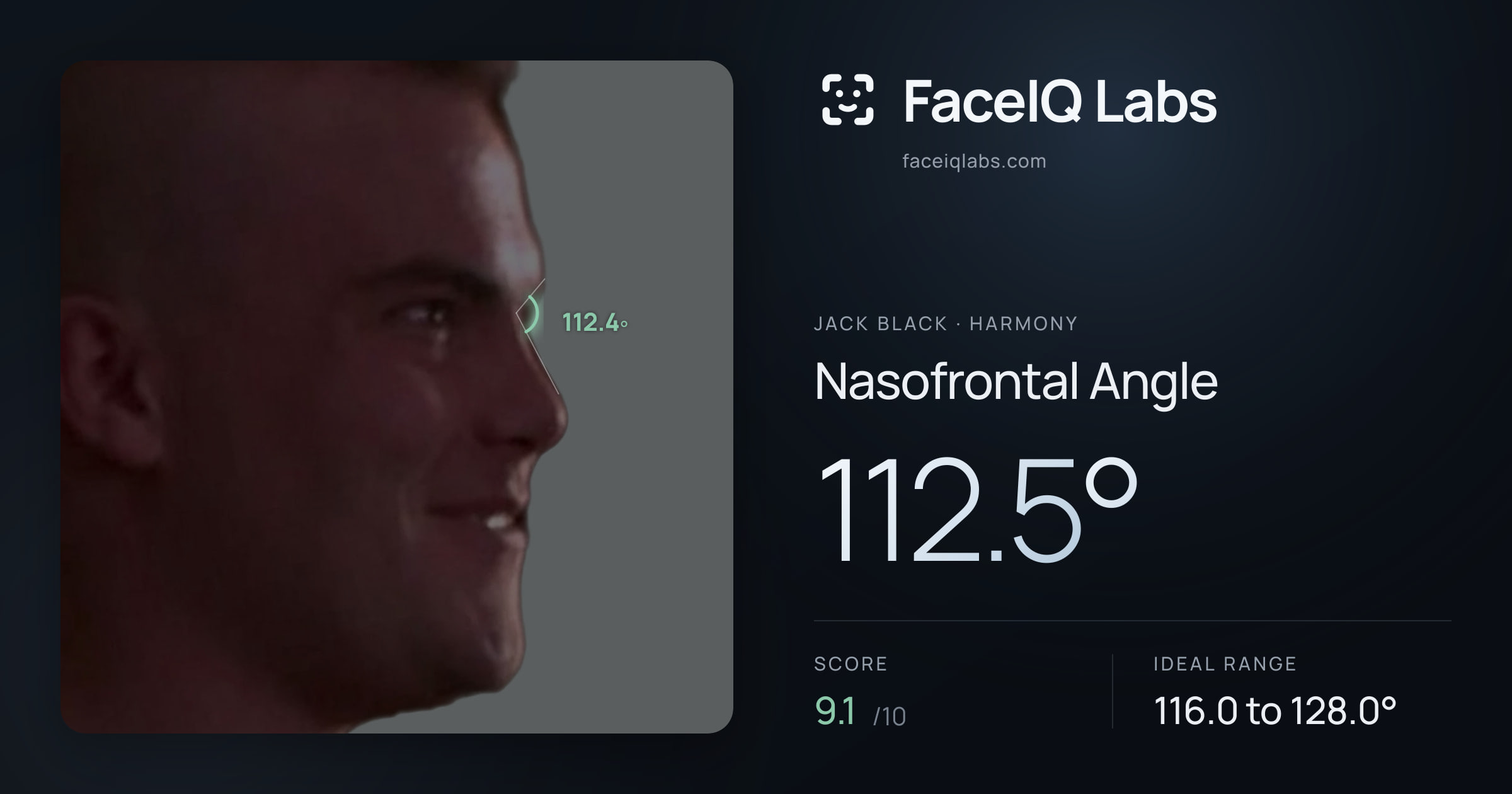 Jack Black Nasofrontal Angle: 112.5°, drawn on the photo
