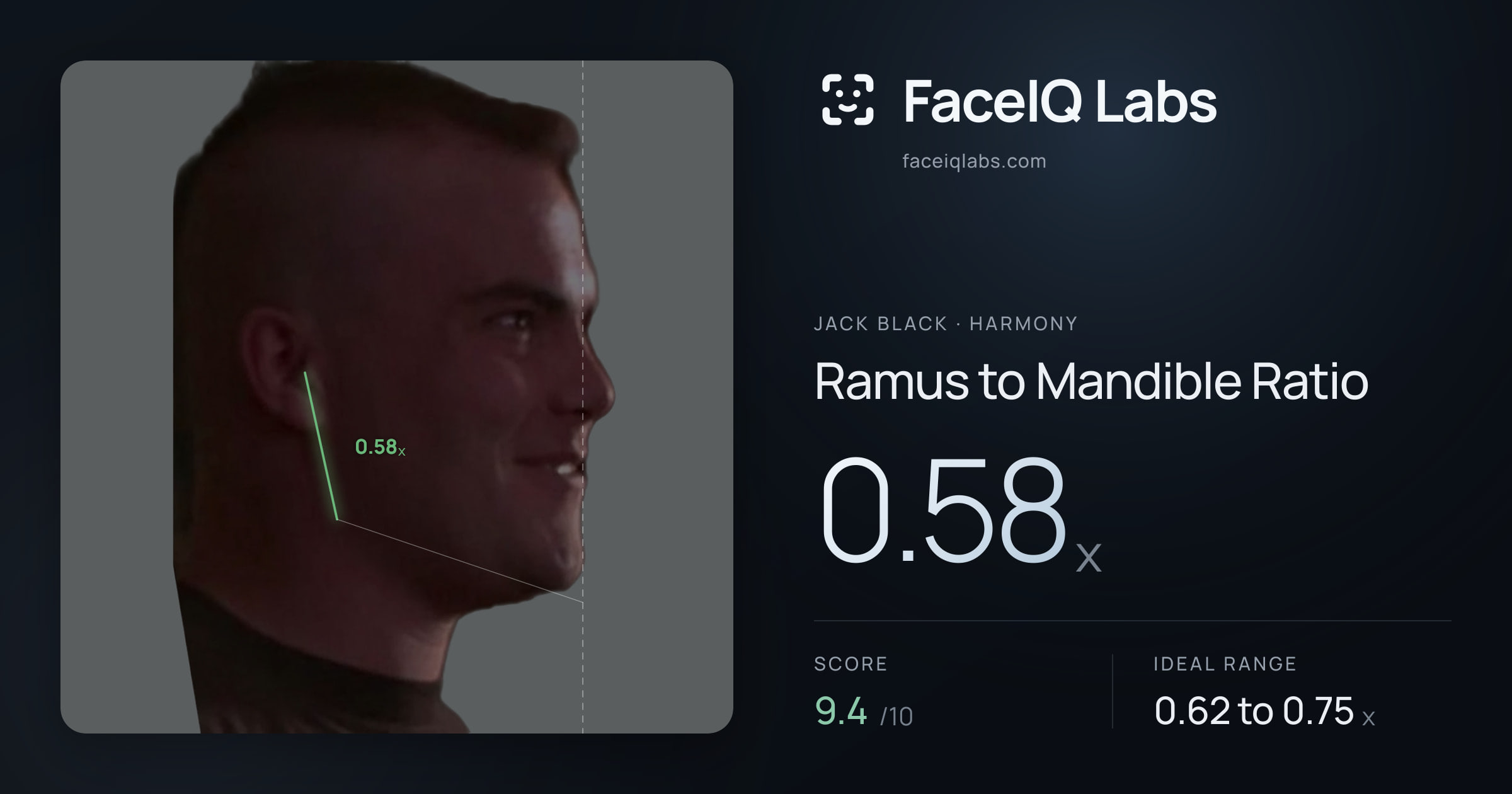 Jack Black Ramus to Mandible Ratio: 0.58x, drawn on the photo