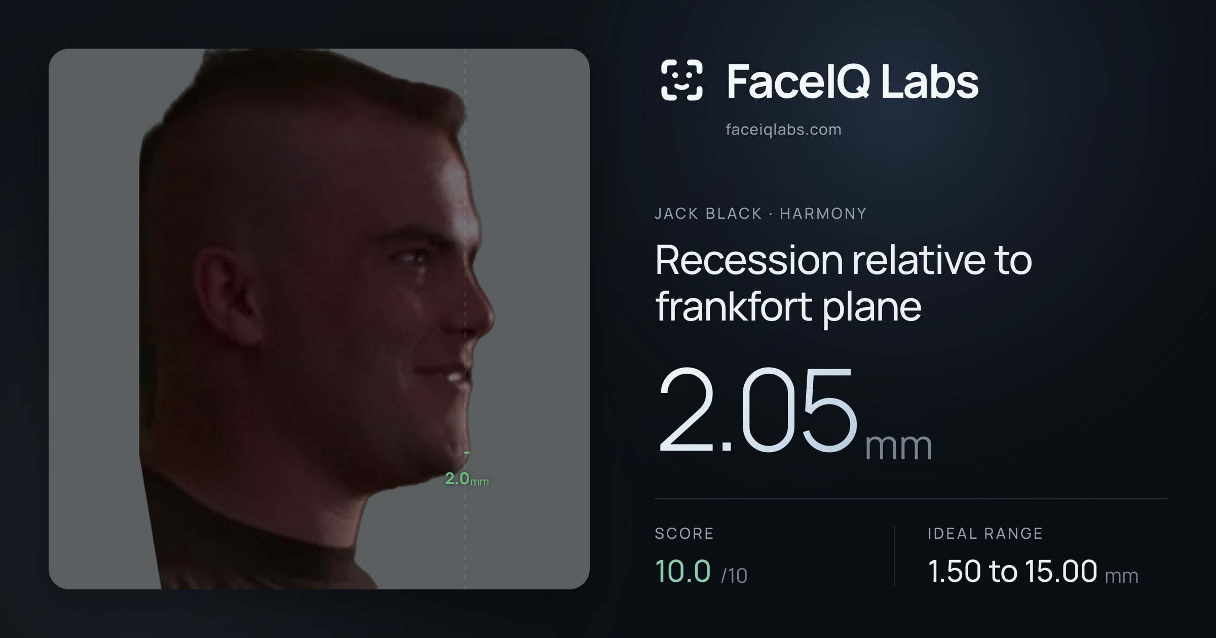 Jack Black Recession relative to frankfort plane: 2.05mm, drawn on the photo