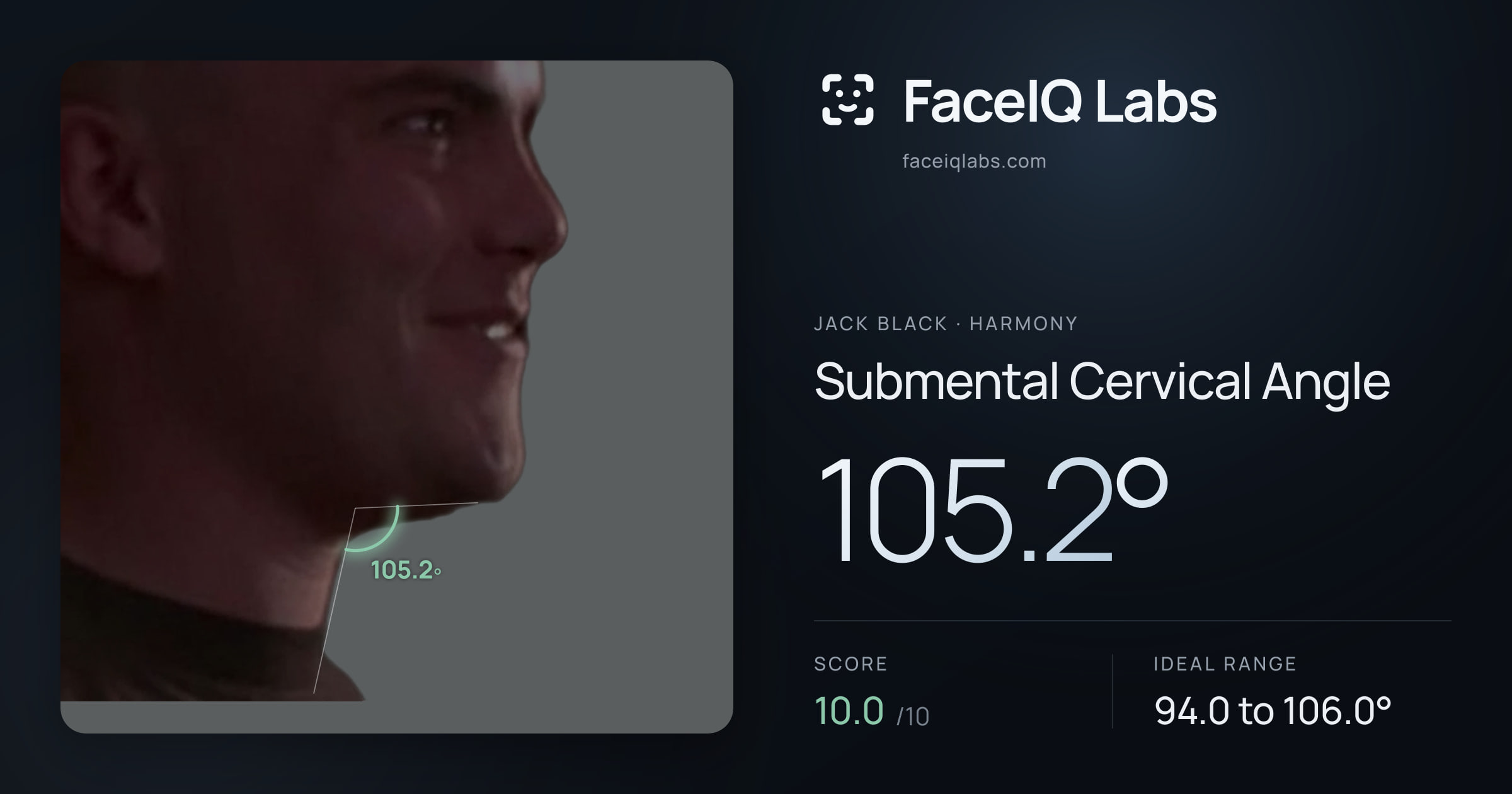Jack Black Submental Cervical Angle: 105.2°, drawn on the photo