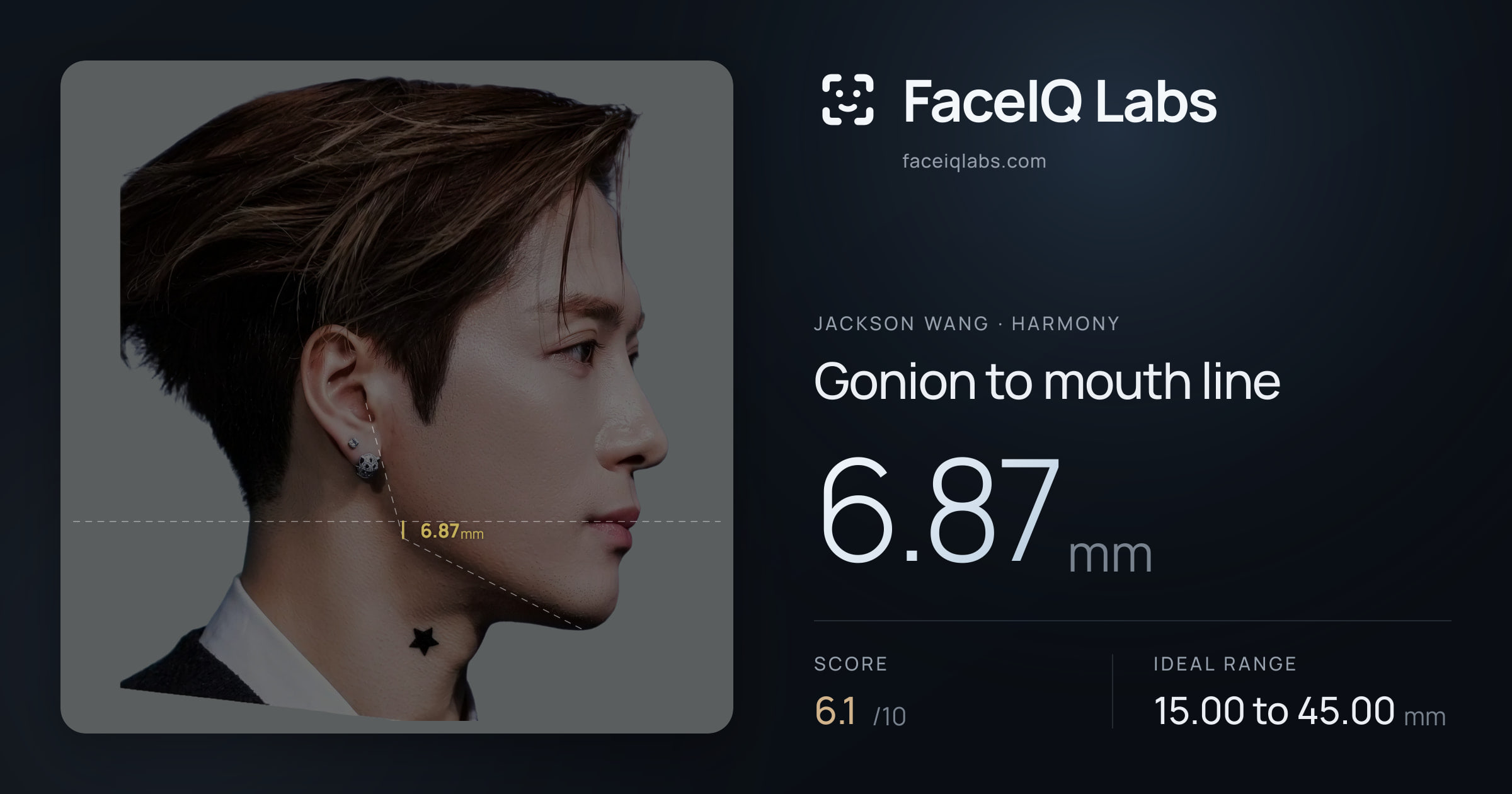 Jackson Wang Gonion to mouth line: 6.87mm, drawn on the photo