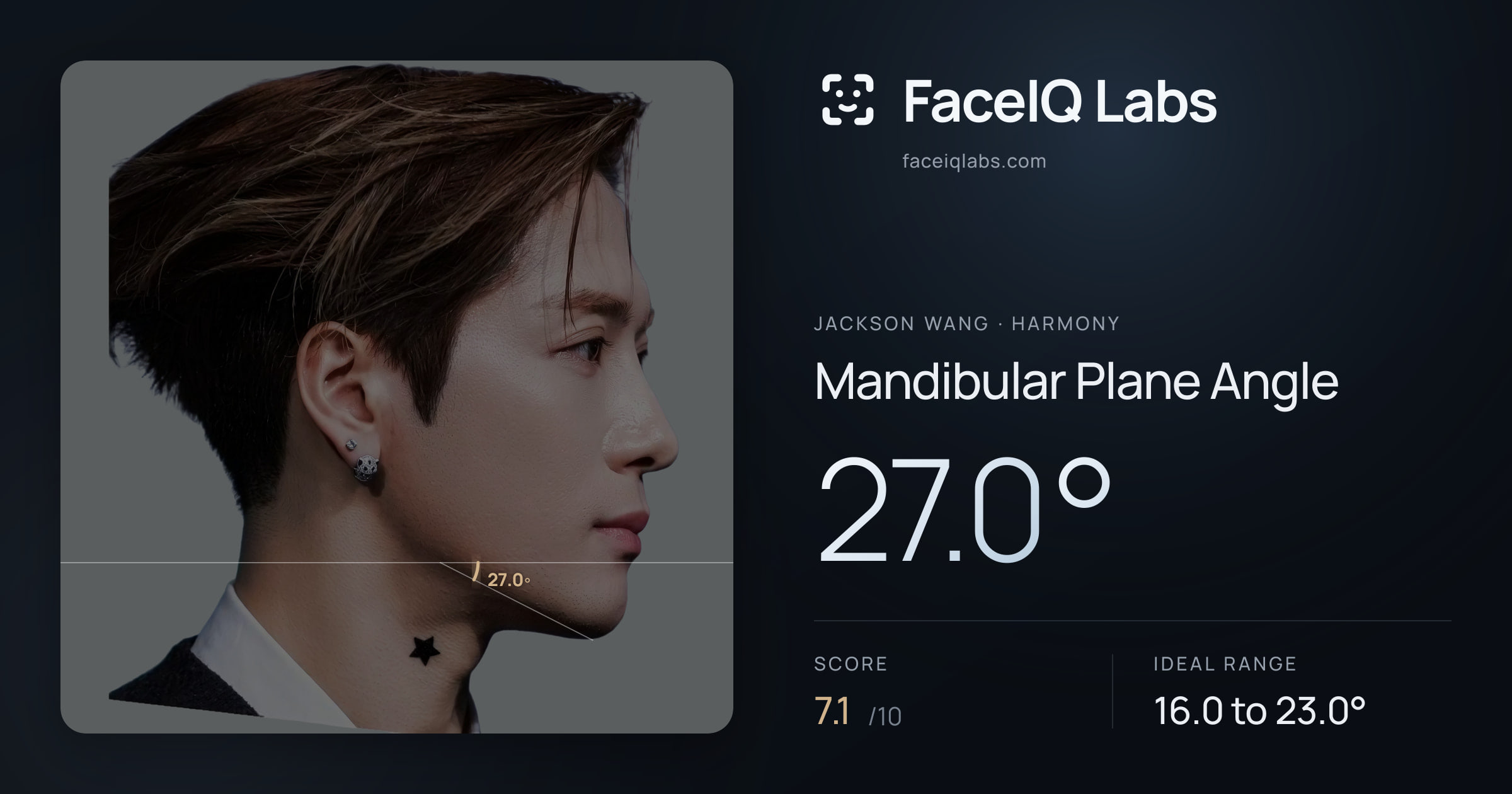 Jackson Wang Mandibular Plane Angle: 27.0°, drawn on the photo