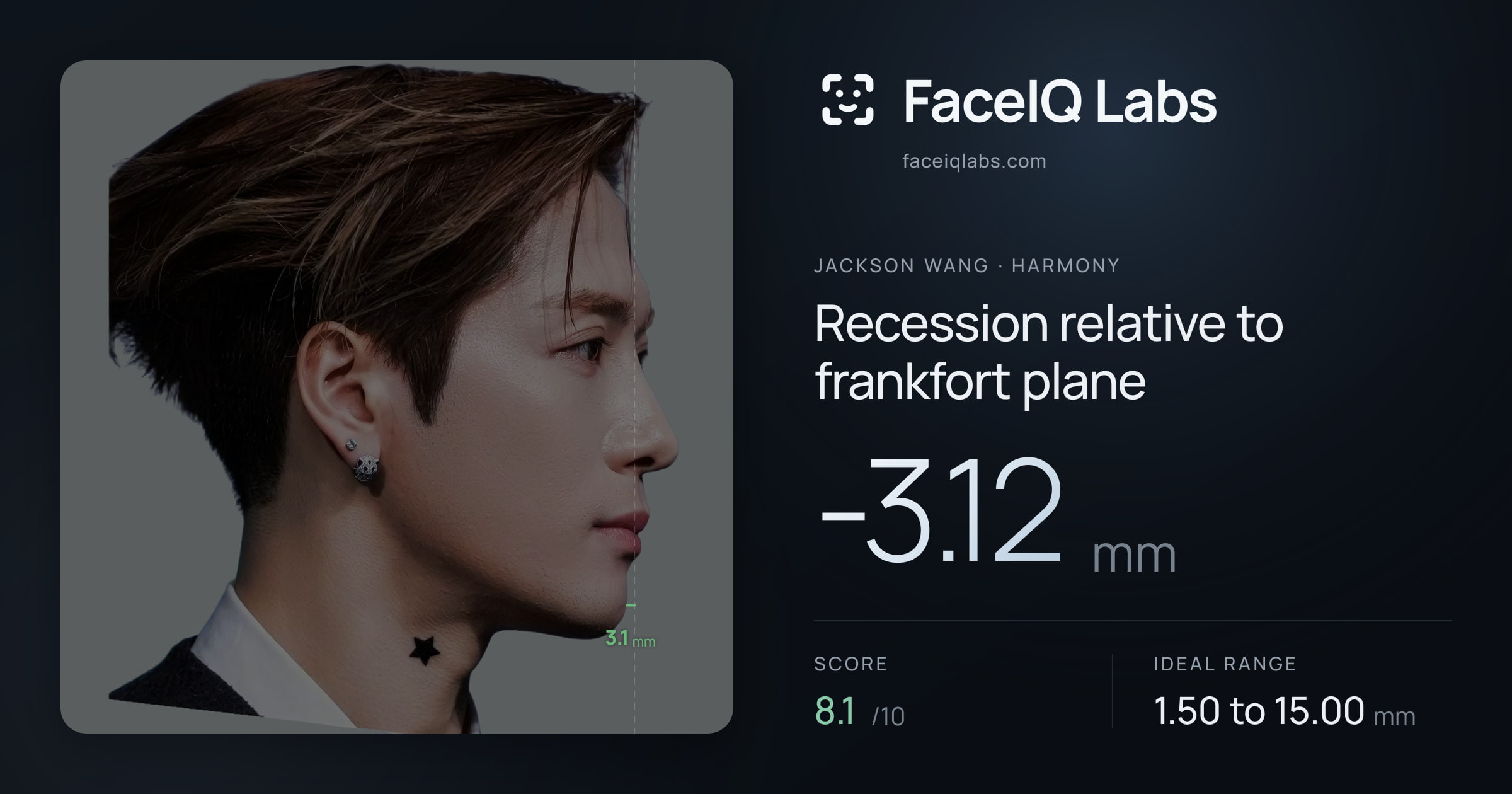 Jackson Wang Recession relative to frankfort plane: -3.12mm, drawn on the photo