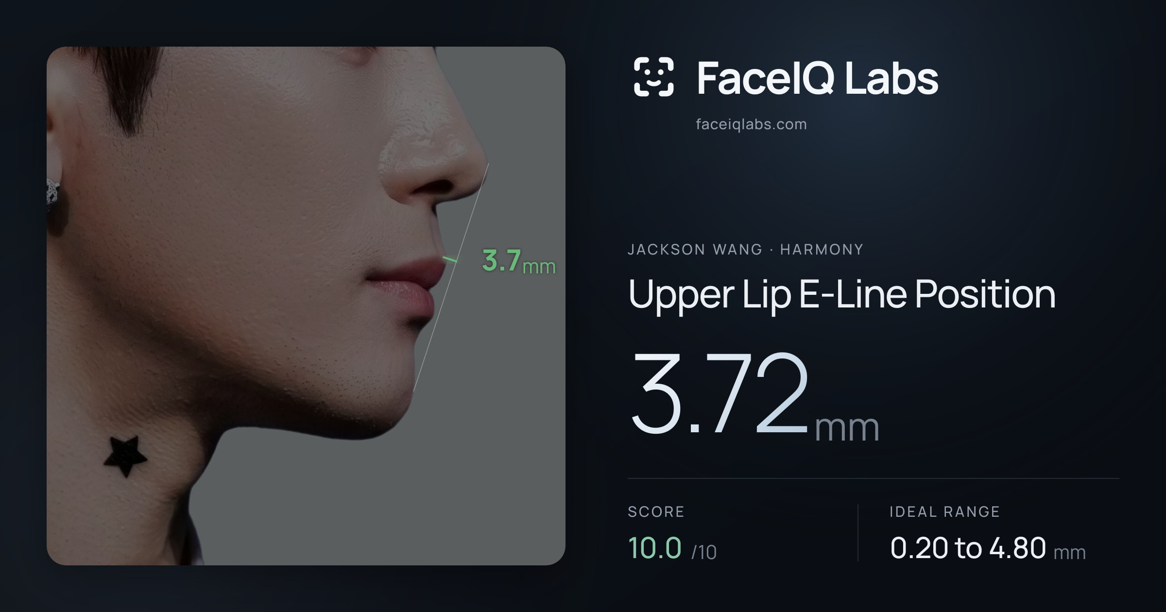 Jackson Wang Upper Lip E-Line Position: 3.72mm, drawn on the photo