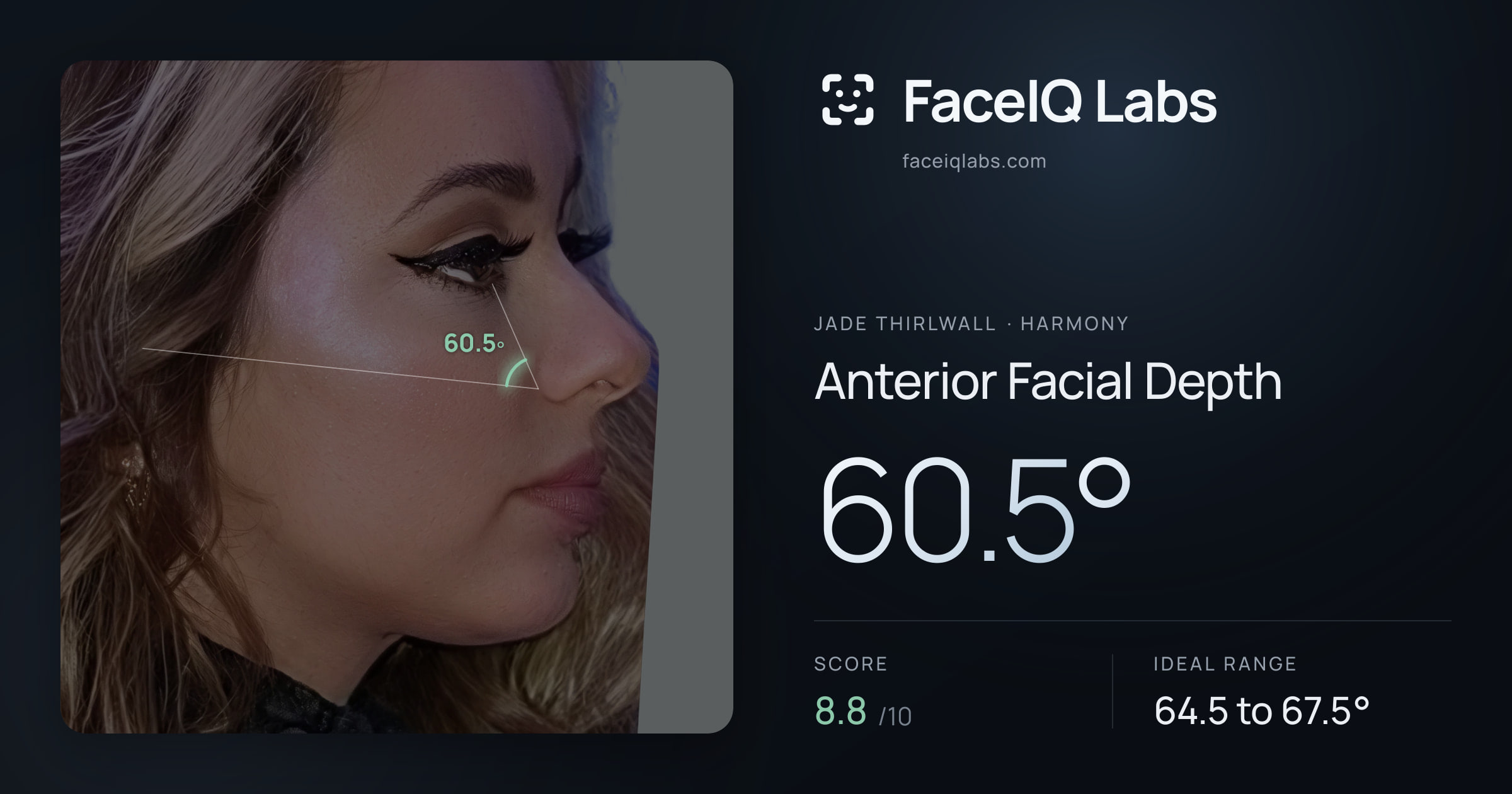 Jade Thirlwall Anterior Facial Depth: 60.5°, drawn on the photo