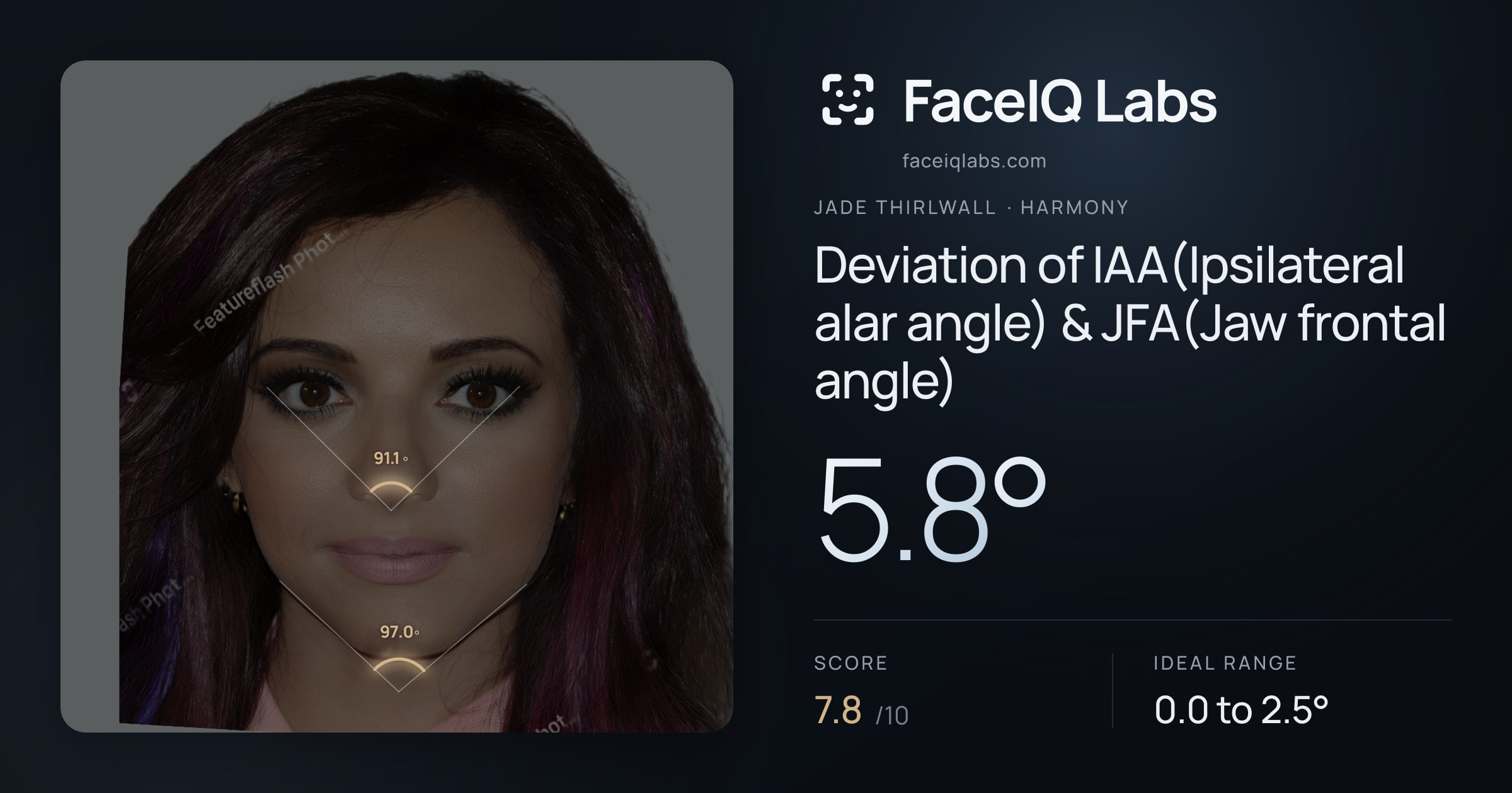 Jade Thirlwall Deviation of IAA(Ipsilateral alar angle) & JFA(Jaw frontal angle): 5.8°, drawn on the photo