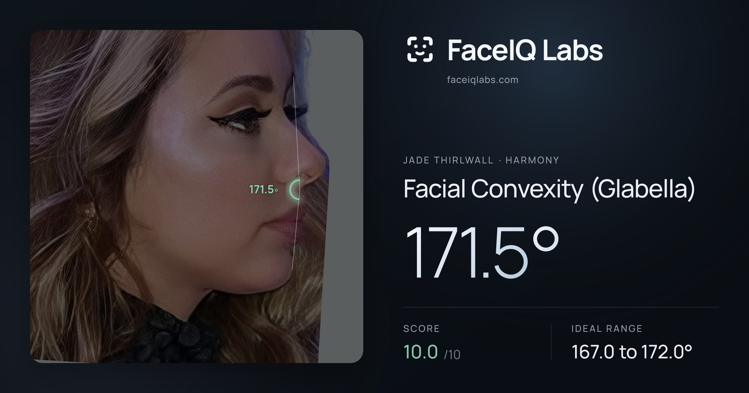 Jade Thirlwall Facial Convexity (Glabella): 171.5°, drawn on the photo