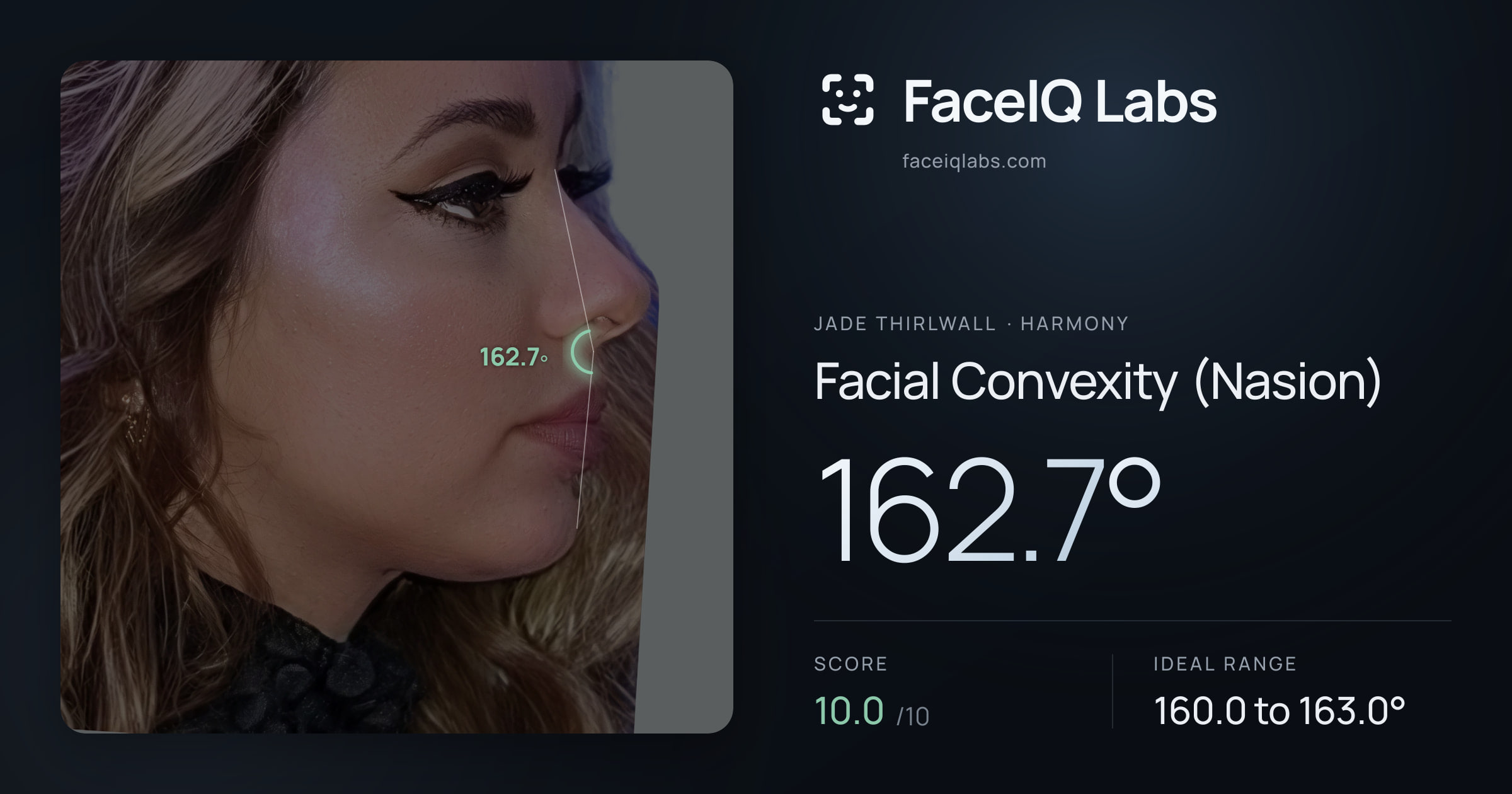 Jade Thirlwall Facial Convexity (Nasion): 162.7°, drawn on the photo
