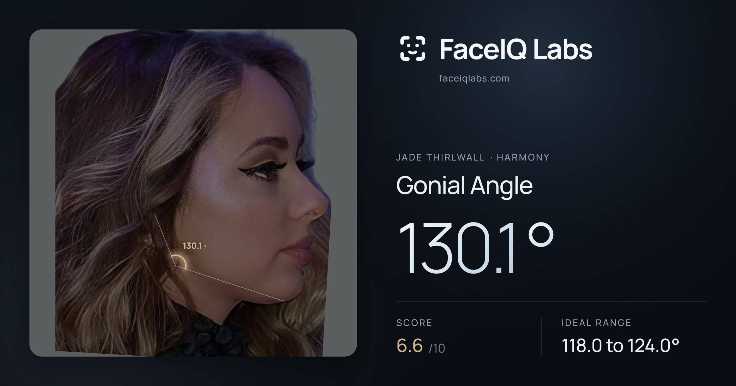 Jade Thirlwall Gonial Angle: 130.1°, drawn on the photo