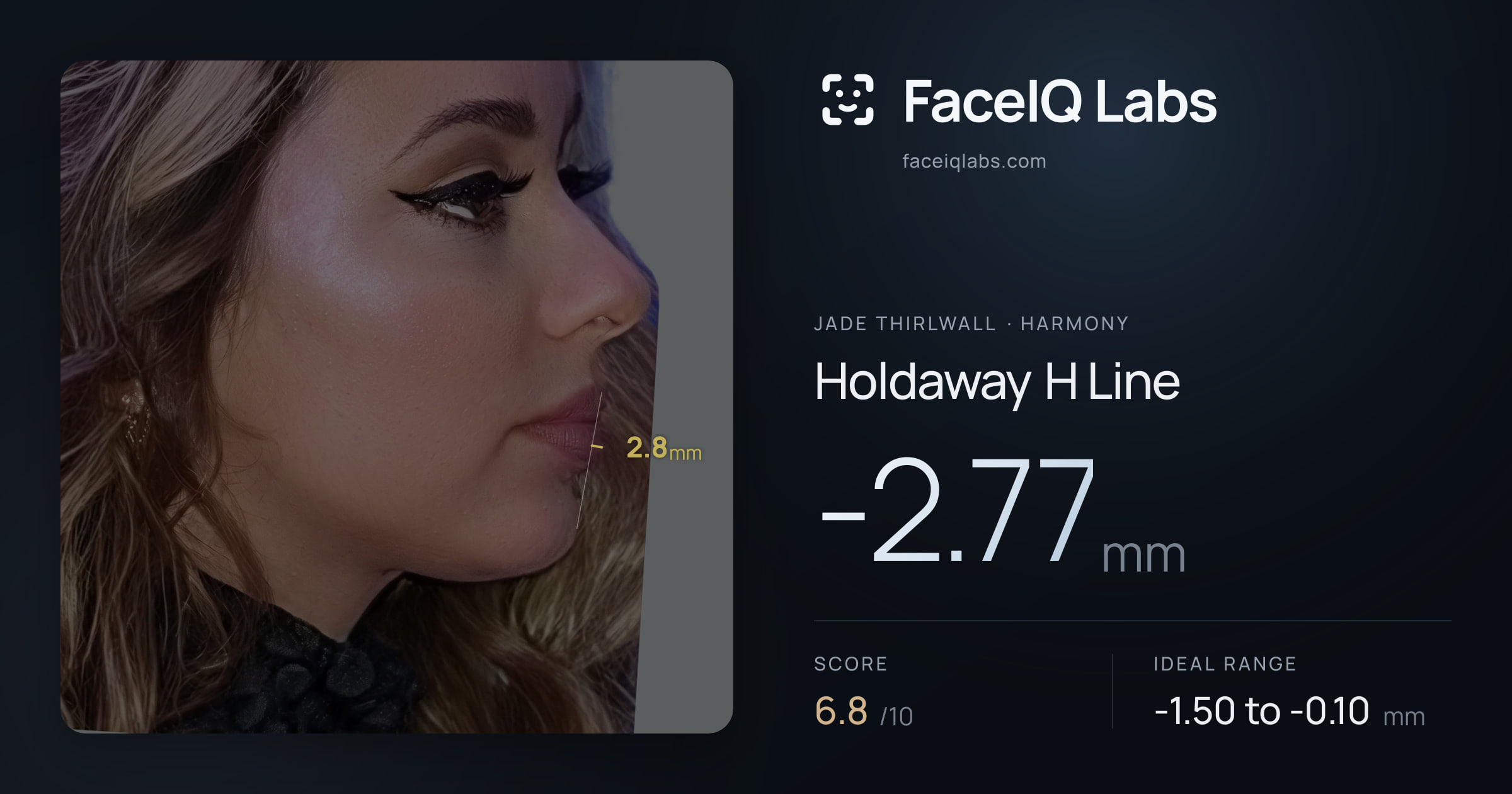 Jade Thirlwall Holdaway H Line: -2.77mm, drawn on the photo
