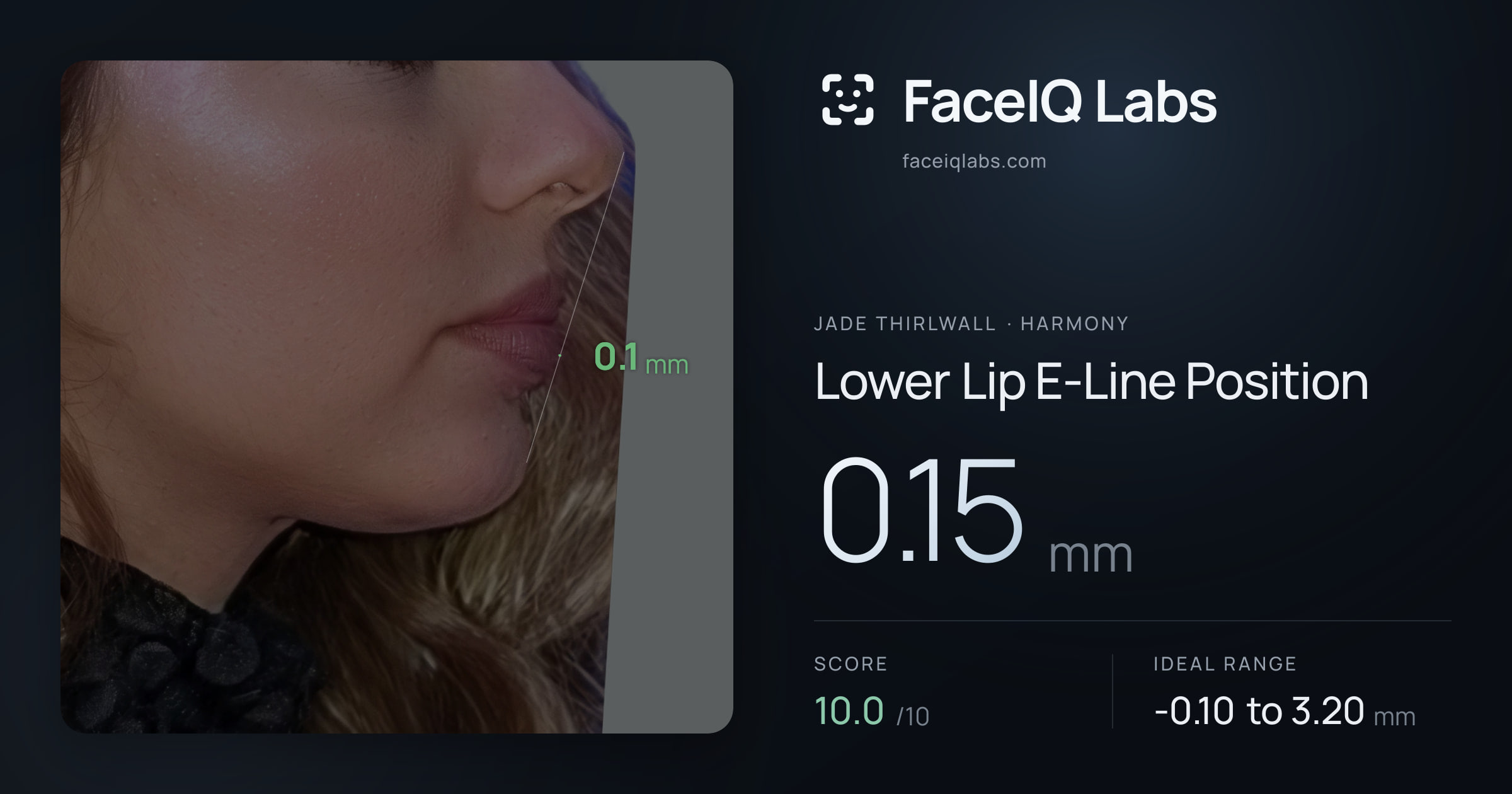 Jade Thirlwall Lower Lip E-Line Position: 0.15mm, drawn on the photo