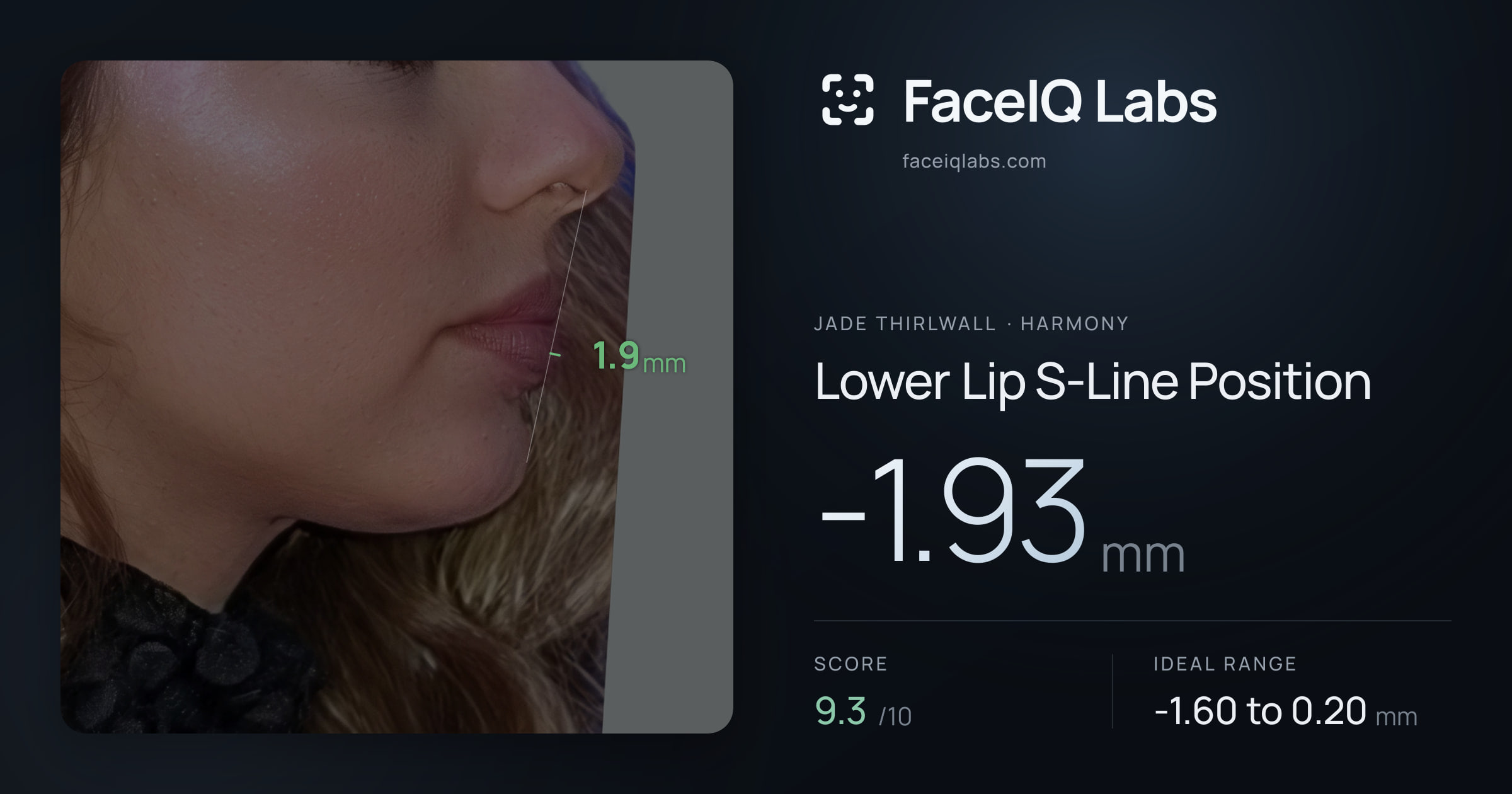 Jade Thirlwall Lower Lip S-Line Position: -1.93mm, drawn on the photo