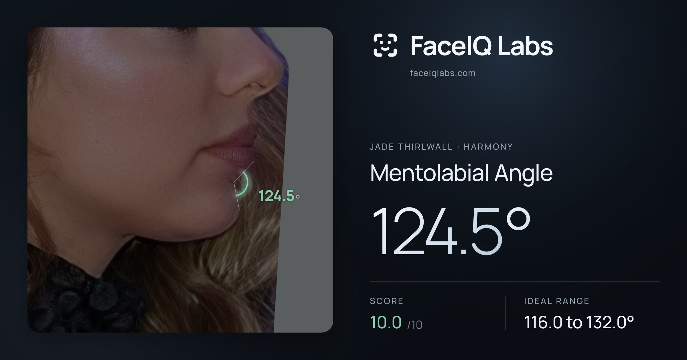 Jade Thirlwall Mentolabial Angle: 124.5°, drawn on the photo