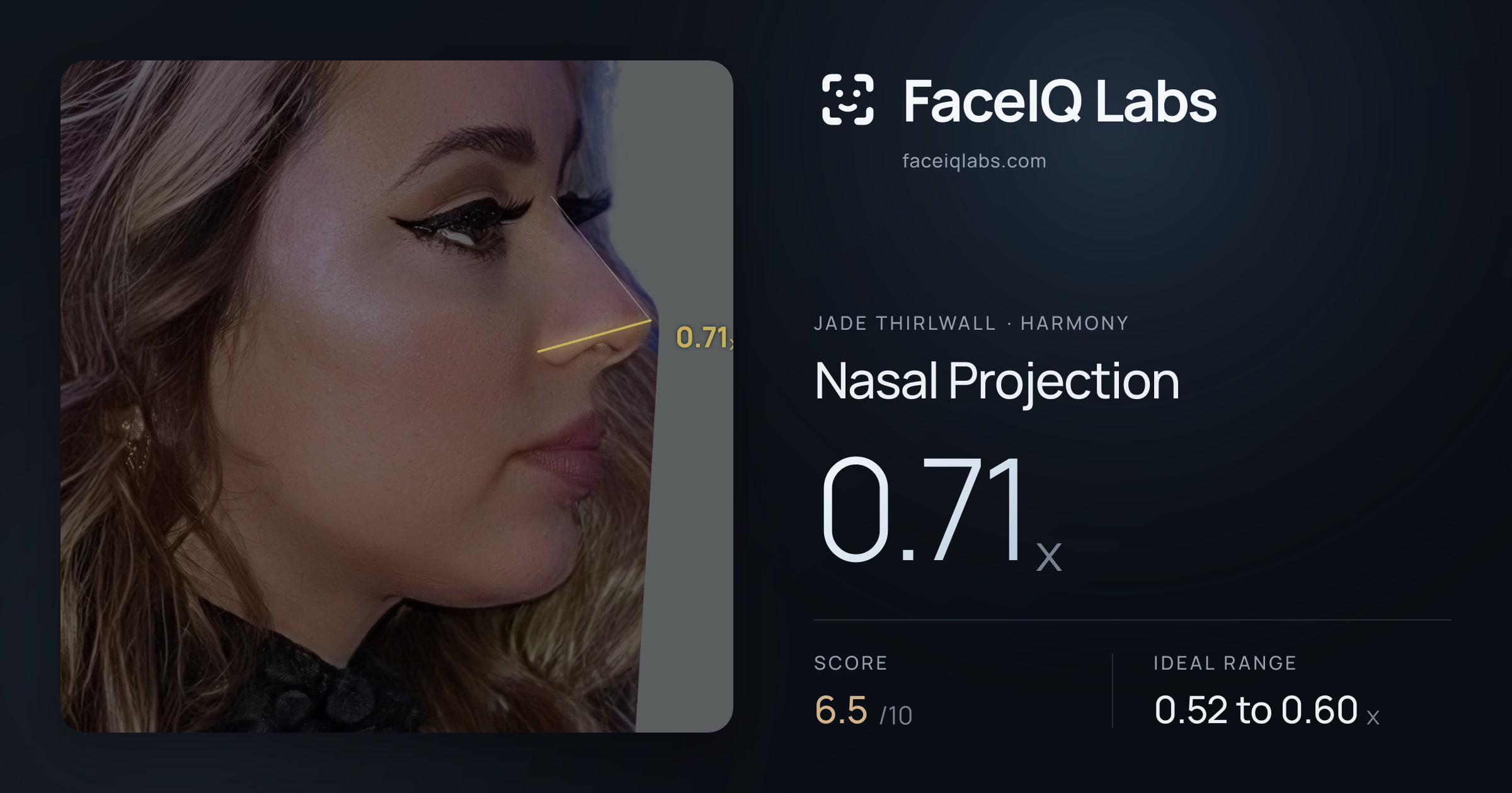 Jade Thirlwall Nasal Projection: 0.71x, drawn on the photo