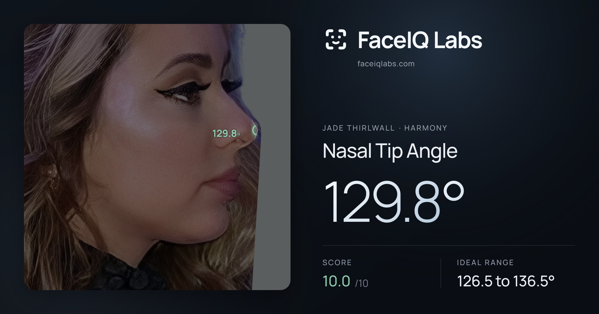 Jade Thirlwall Nasal Tip Angle: 129.8°, drawn on the photo