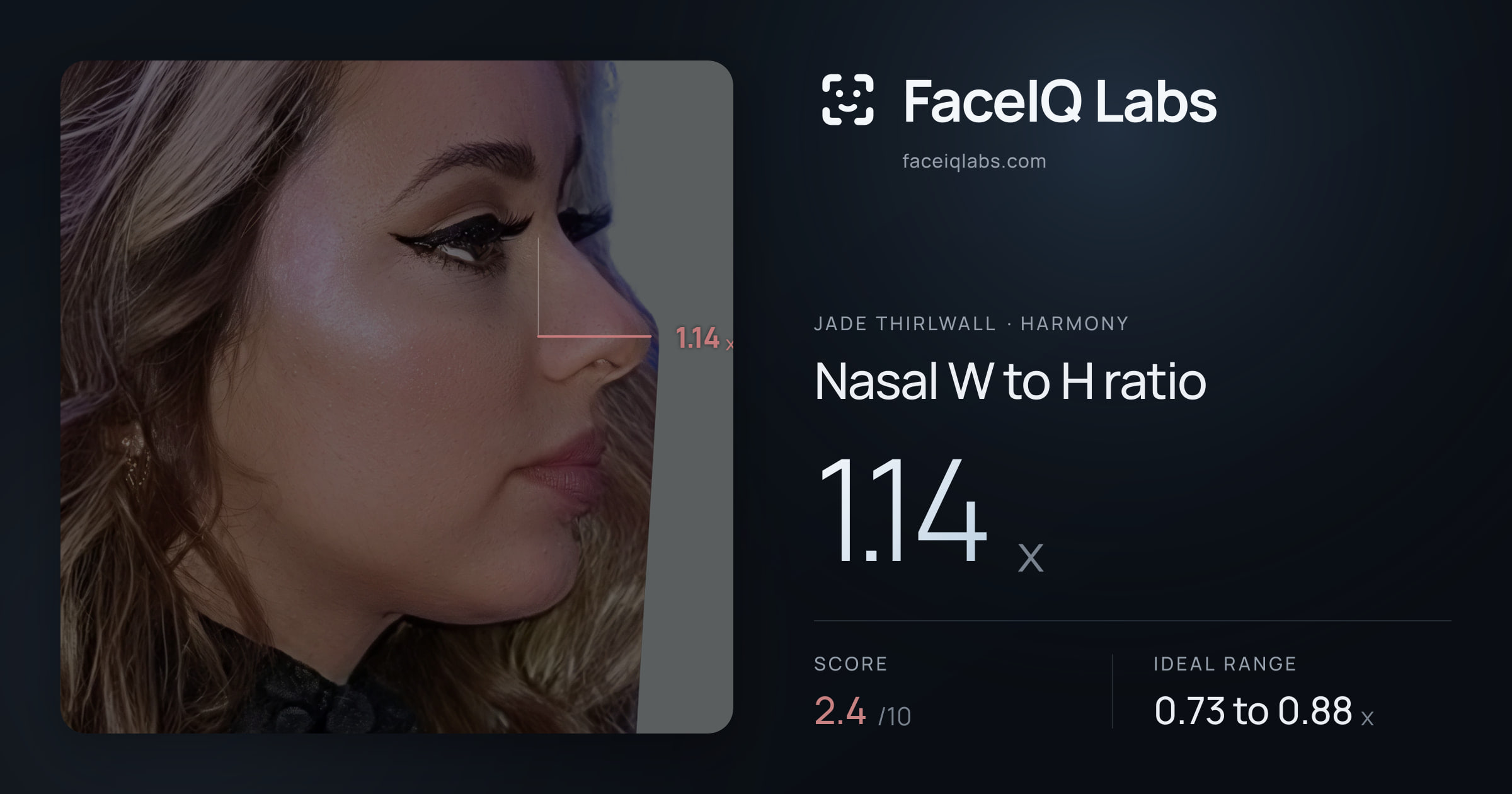 Jade Thirlwall Nasal W to H ratio: 1.14x, drawn on the photo