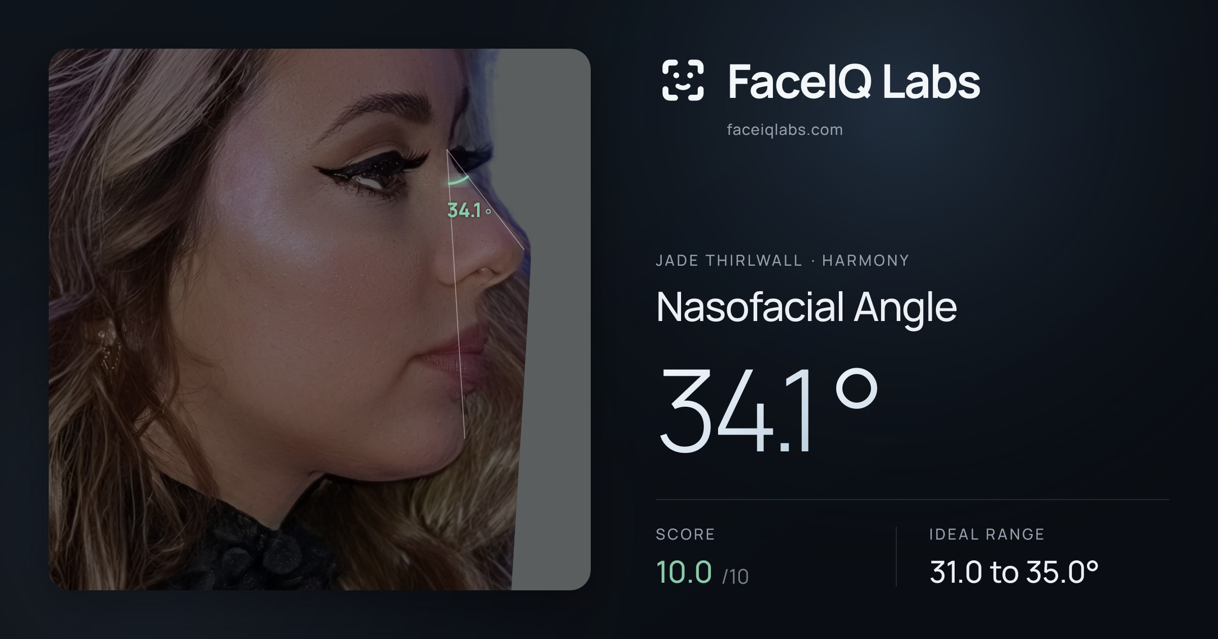 Jade Thirlwall Nasofacial Angle: 34.1°, drawn on the photo