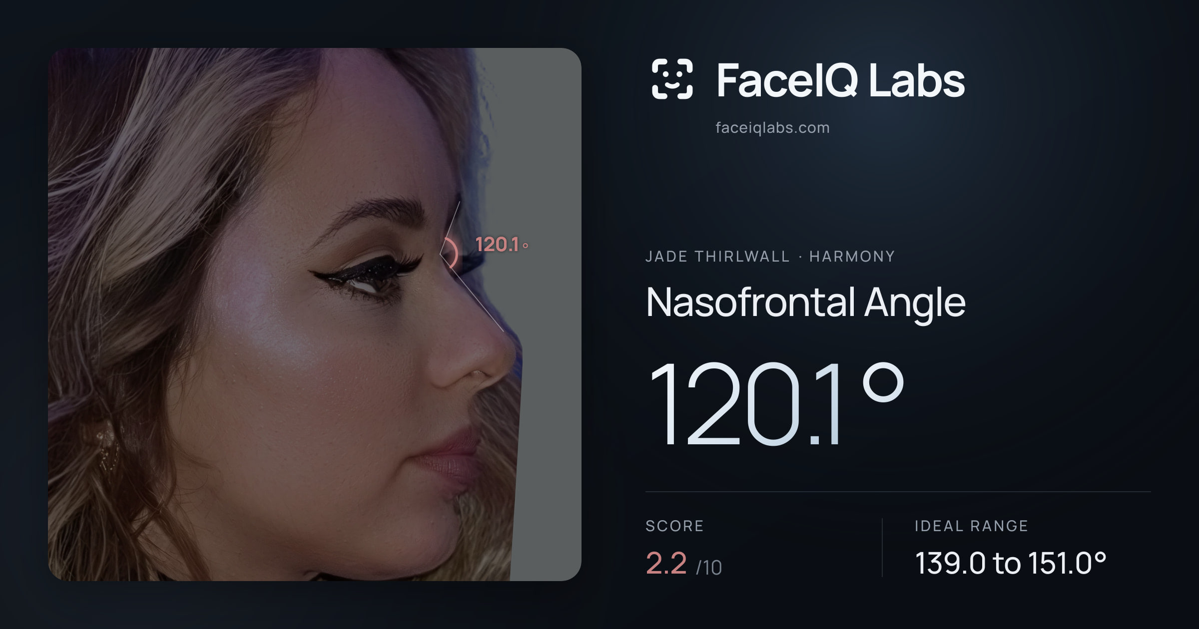 Jade Thirlwall Nasofrontal Angle: 120.1°, drawn on the photo