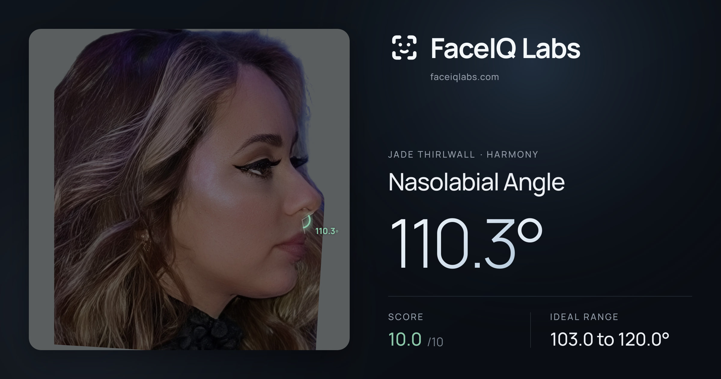 Jade Thirlwall Nasolabial Angle: 110.3°, drawn on the photo