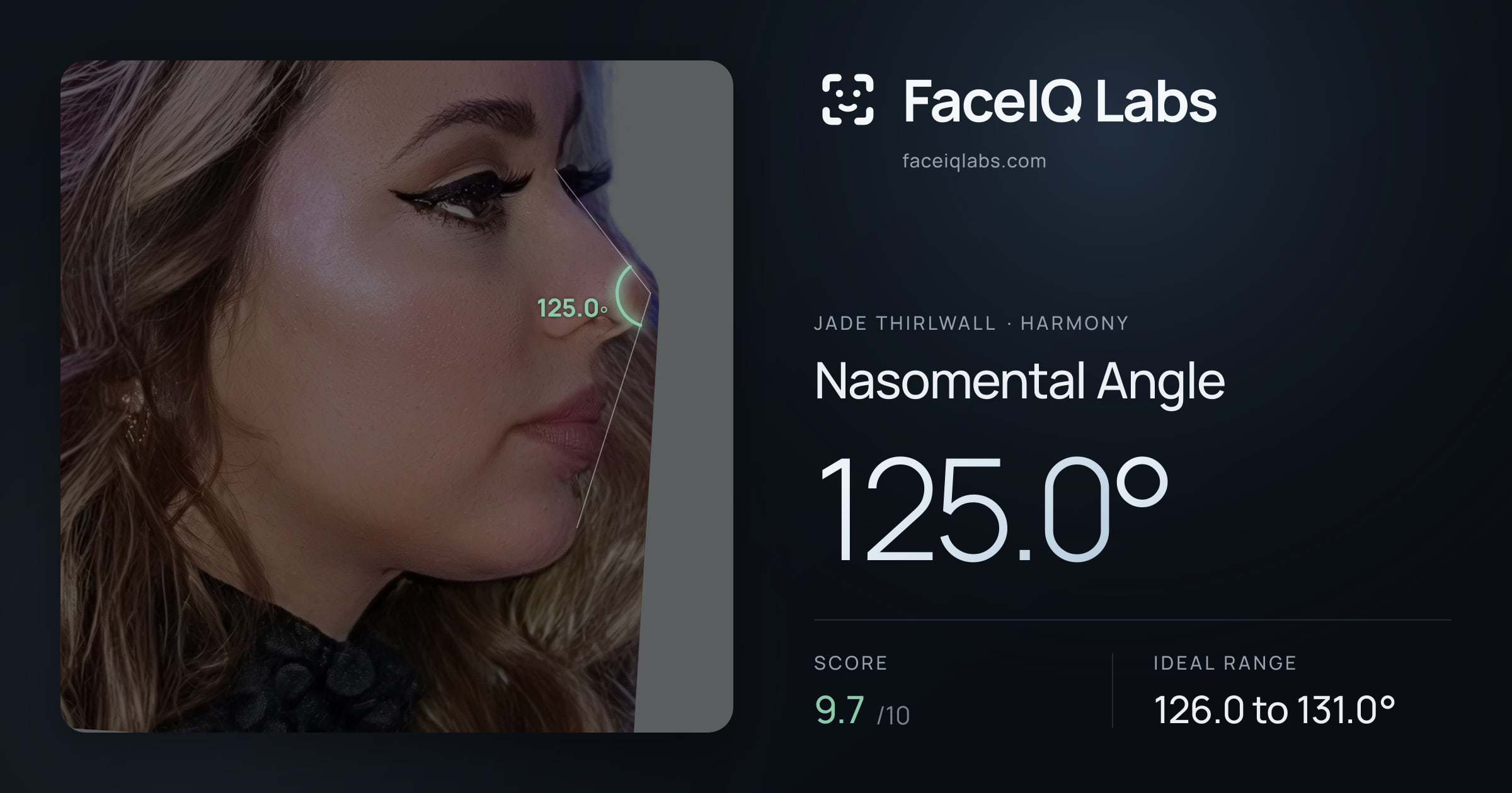 Jade Thirlwall Nasomental Angle: 125.0°, drawn on the photo