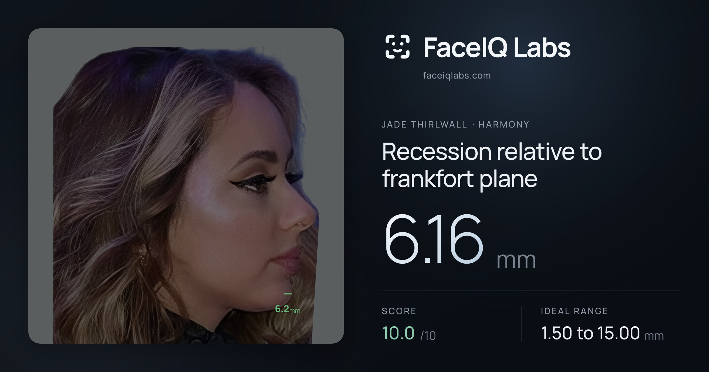 Jade Thirlwall Recession relative to frankfort plane: 6.16mm, drawn on the photo