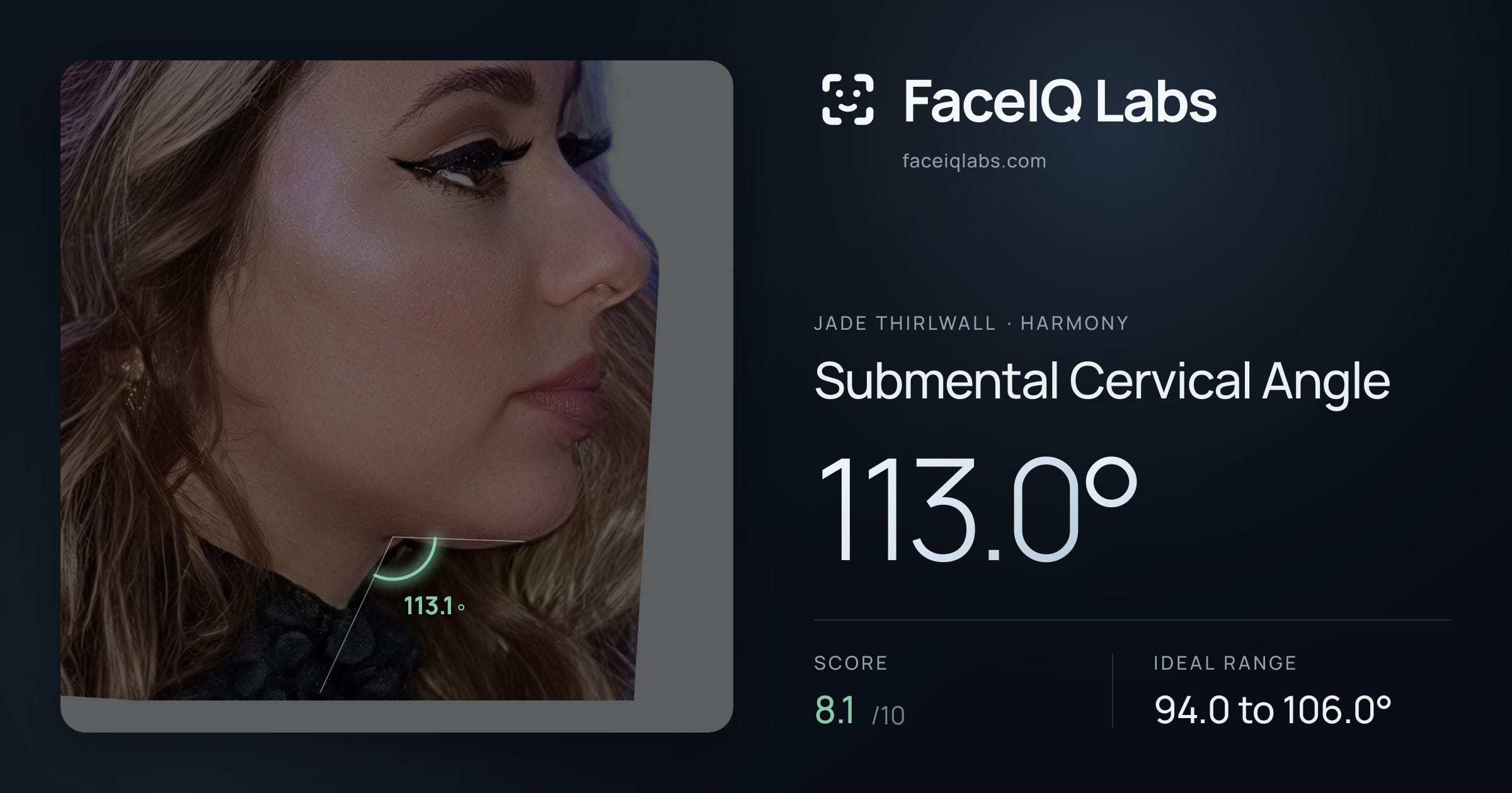 Jade Thirlwall Submental Cervical Angle: 113.0°, drawn on the photo