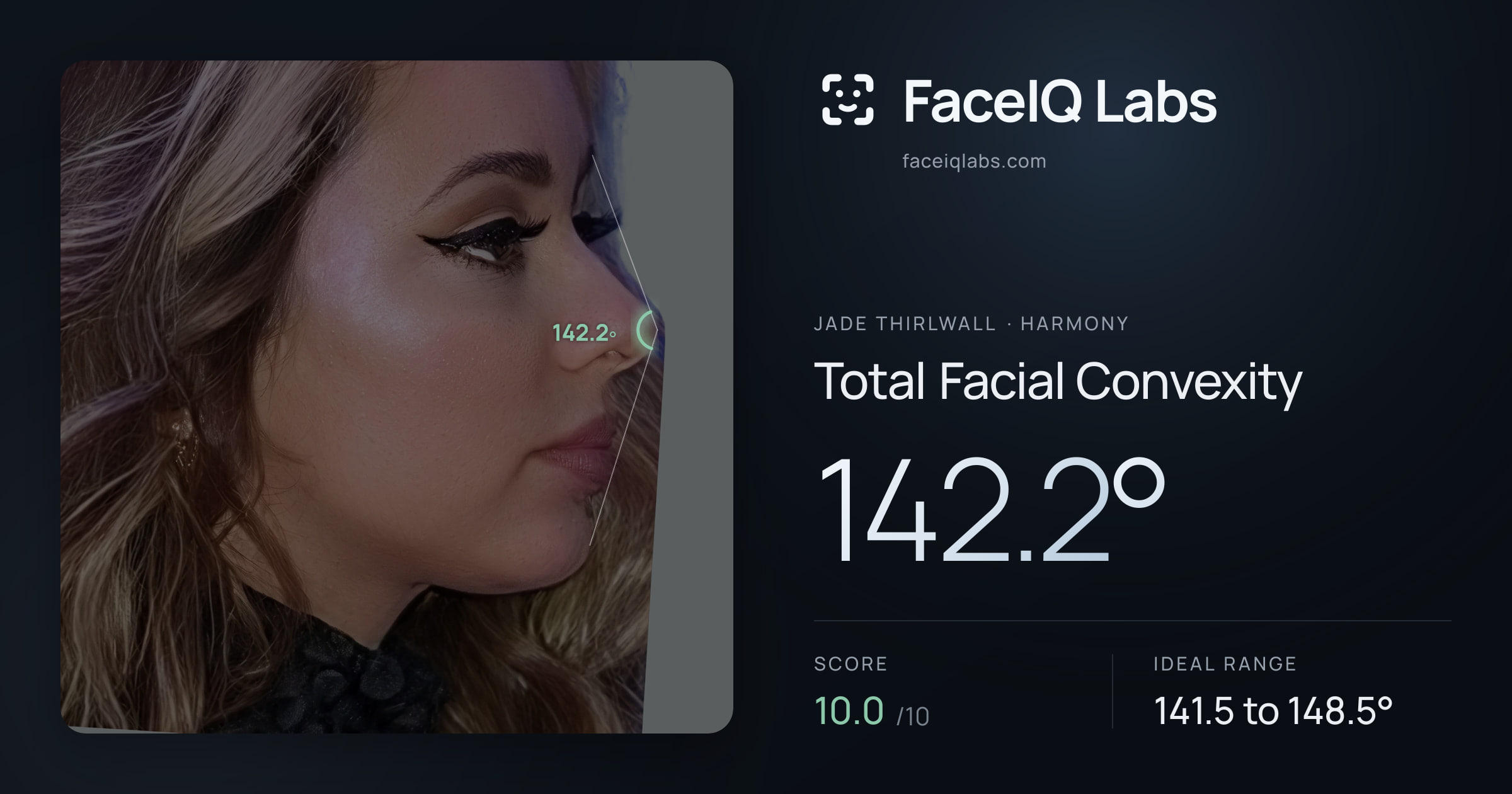 Jade Thirlwall Total Facial Convexity: 142.2°, drawn on the photo