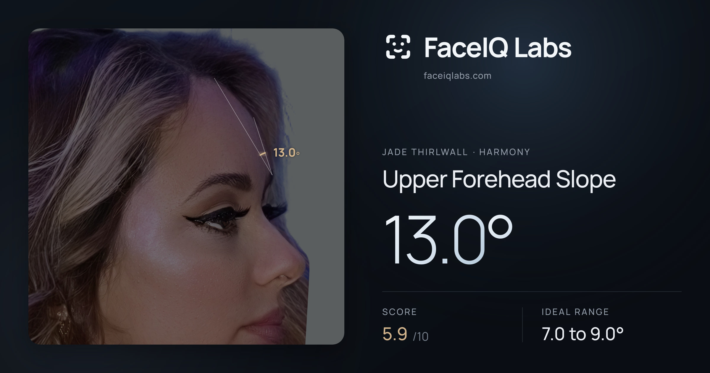 Jade Thirlwall Upper Forehead Slope: 13.0°, drawn on the photo
