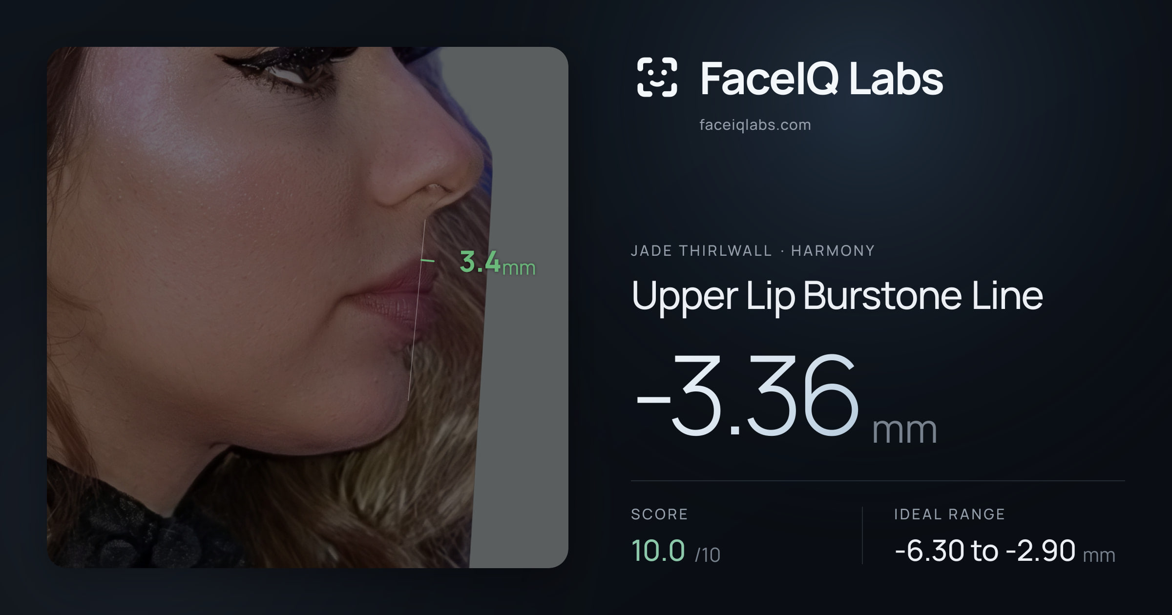 Jade Thirlwall Upper Lip Burstone Line: -3.36mm, drawn on the photo