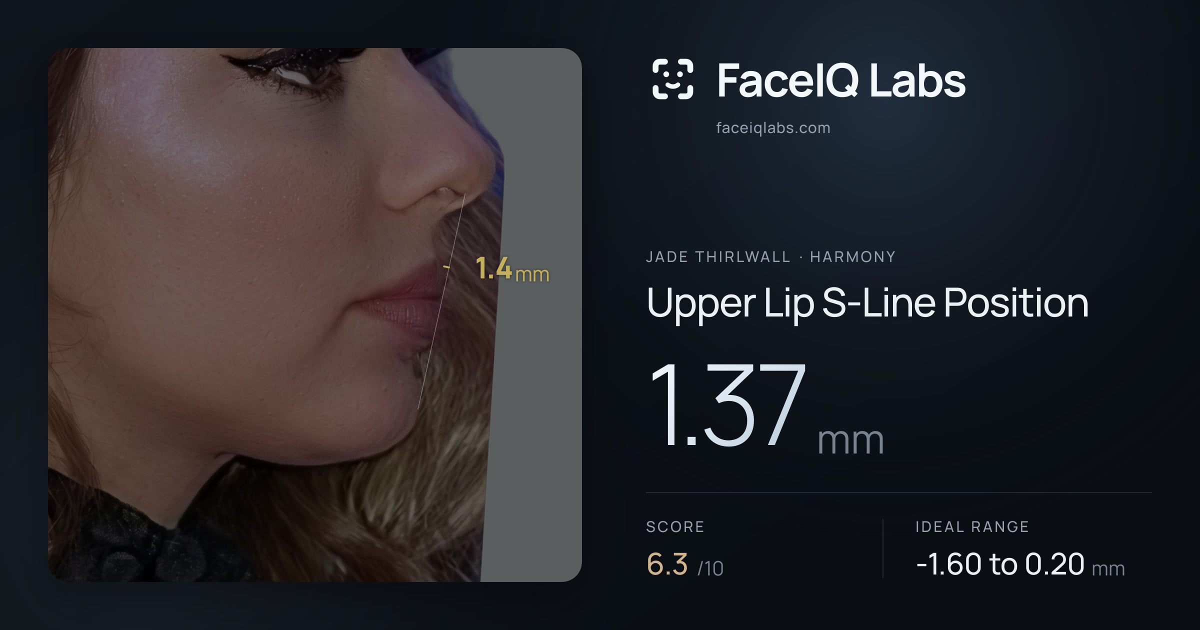 Jade Thirlwall Upper Lip S-Line Position: 1.37mm, drawn on the photo