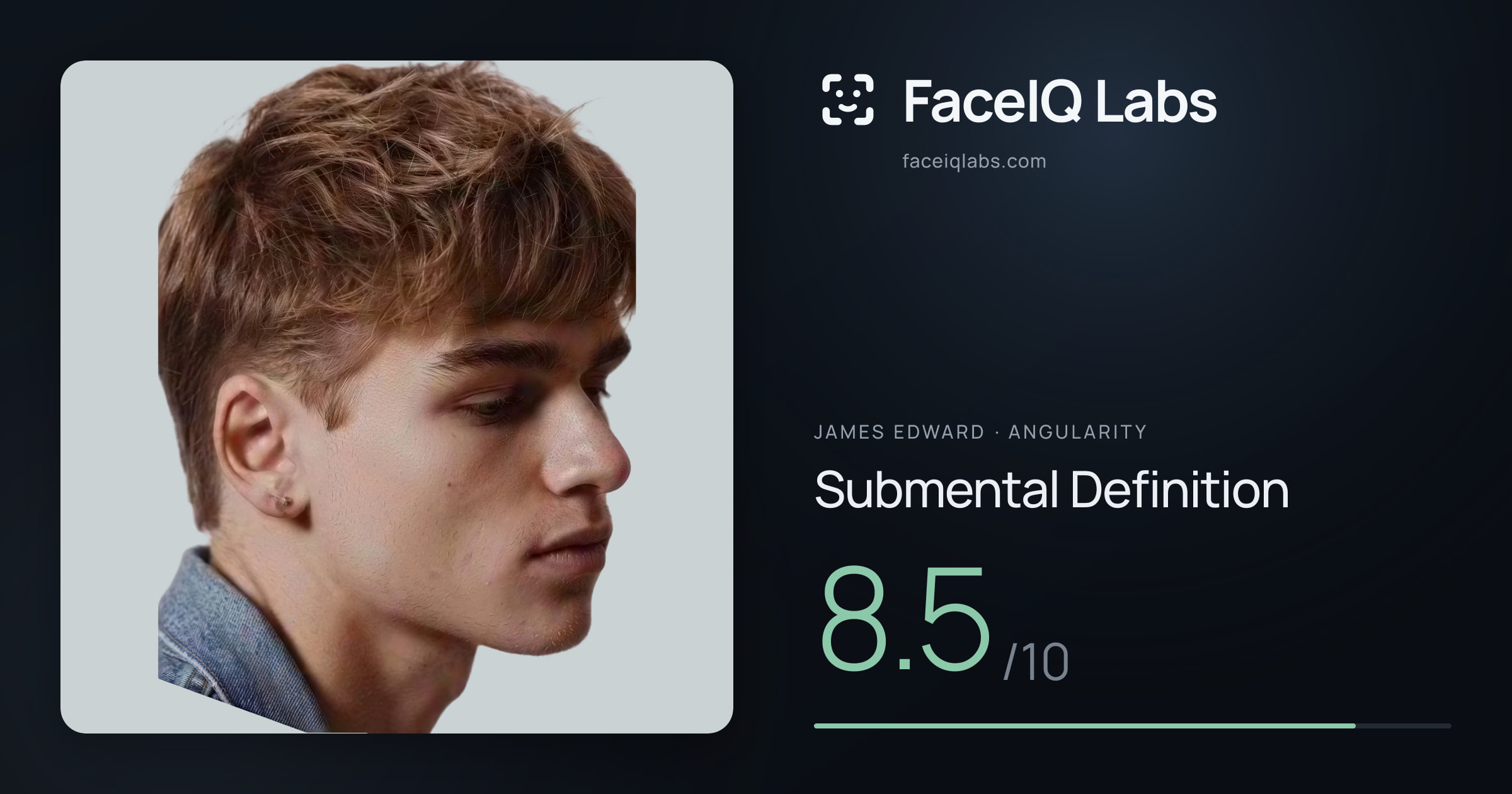 James Edward Submental Definition: 8.5/10, drawn on the photo