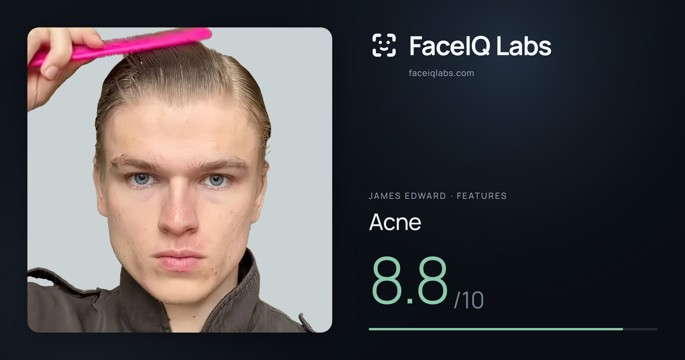 James Edward Acne: 8.8/10, drawn on the photo