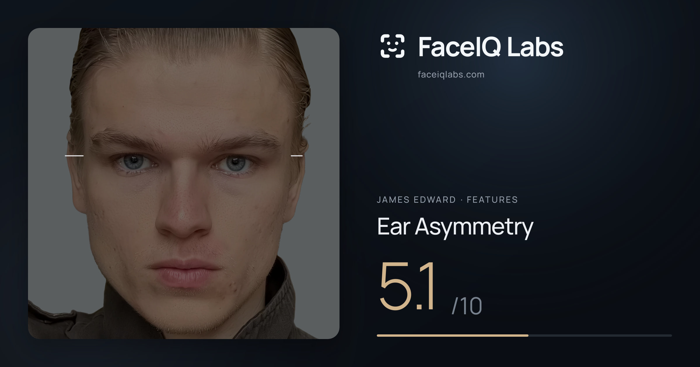 James Edward Ear Asymmetry: 5.1/10, drawn on the photo