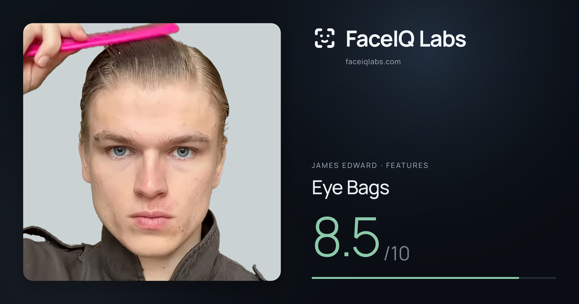James Edward Eye Bags: 8.5/10, drawn on the photo