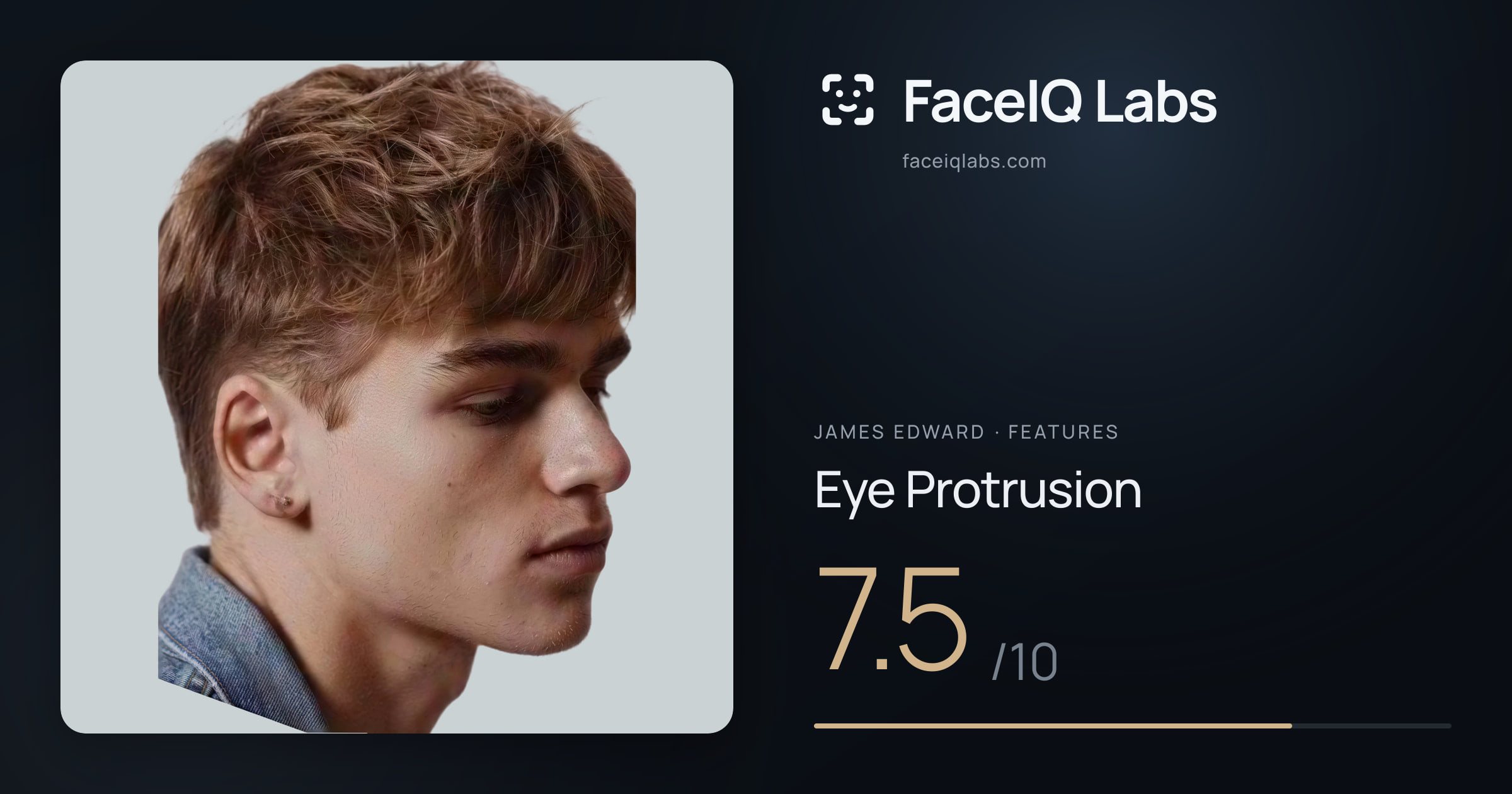 James Edward Eye Protrusion: 7.5/10, drawn on the photo