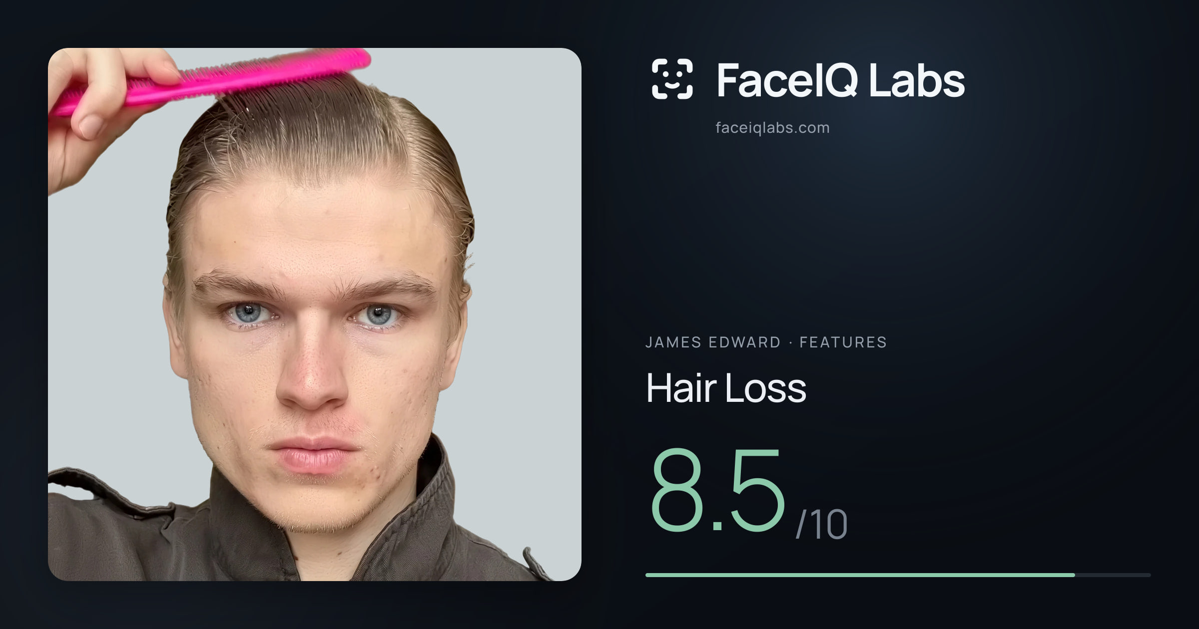 James Edward Hair Loss: 8.5/10, drawn on the photo