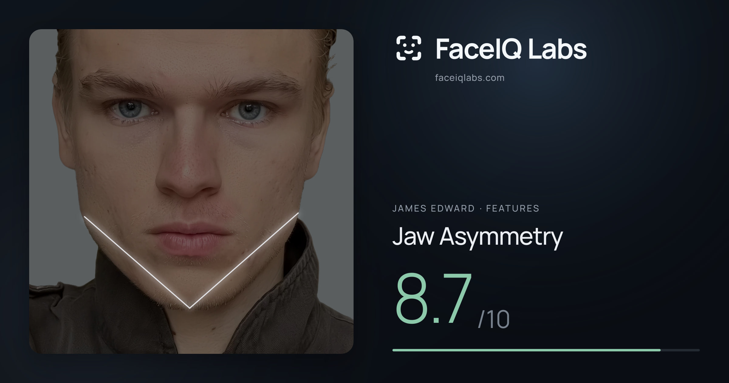 James Edward Jaw Asymmetry: 8.7/10, drawn on the photo