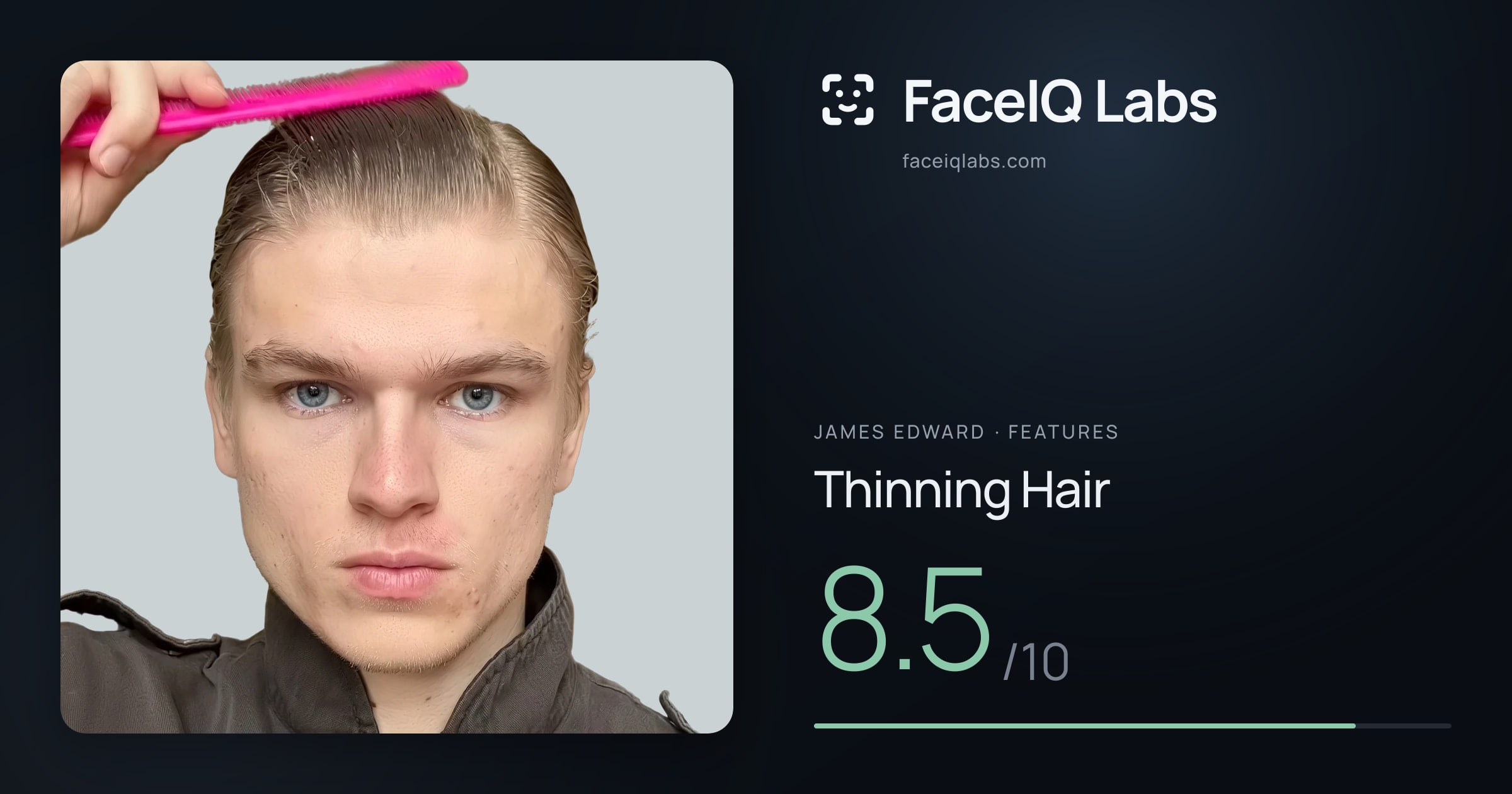 James Edward Thinning Hair: 8.5/10, drawn on the photo