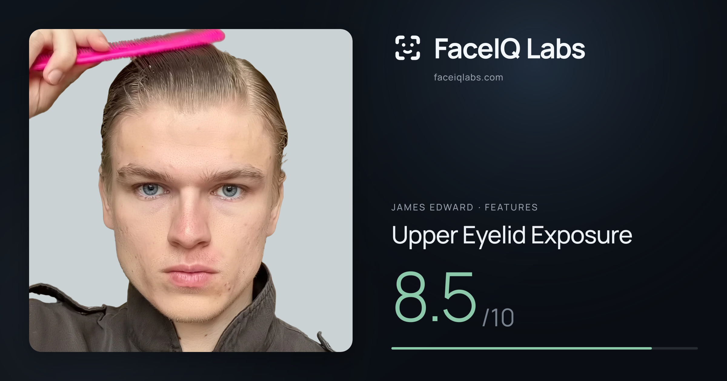 James Edward Upper Eyelid Exposure: 8.5/10, drawn on the photo