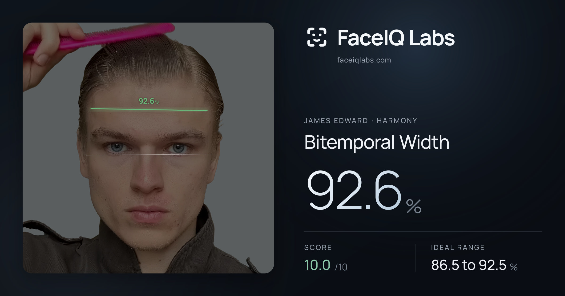 James Edward Bitemporal Width: 92.6%, drawn on the photo